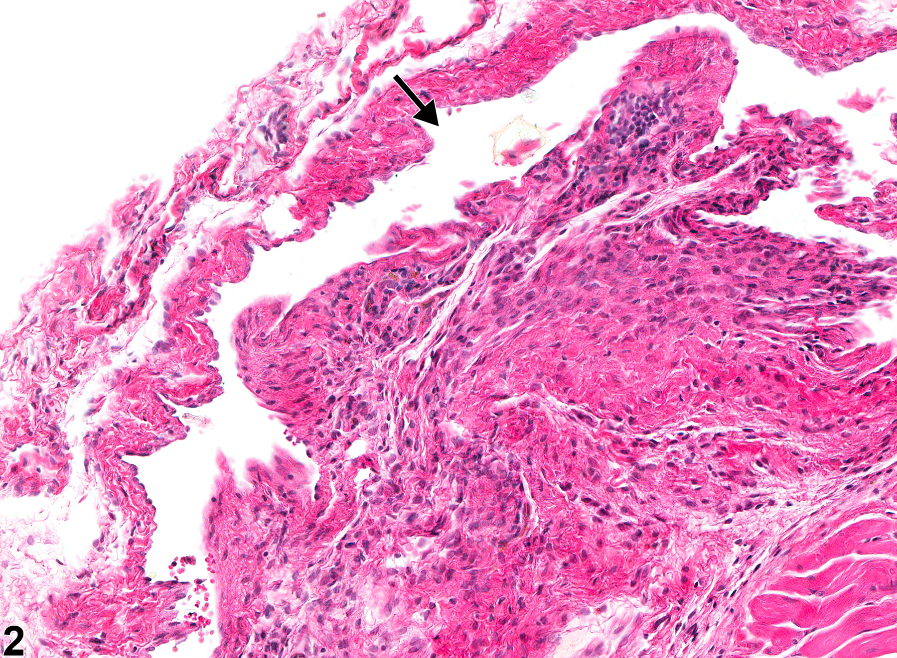 Image of angiectasis in the esophagus from a female F344/N rat in a chronic study