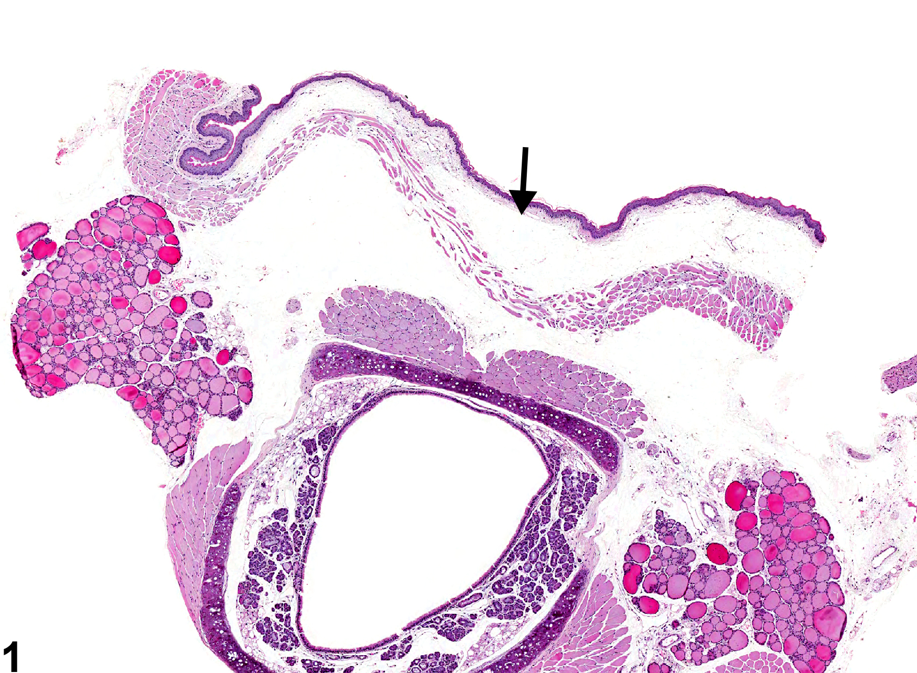 Image of edema in the esophagus from a male B6C3F1 mouse in a chronic study