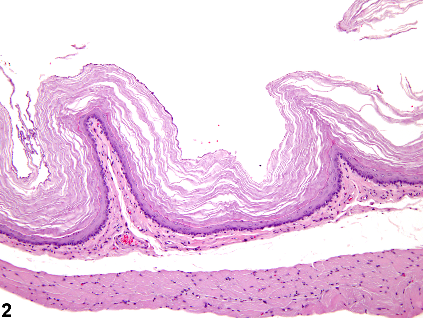 Image of hyperkeratosis in the esophagus from a female F344/N rat in a chronic study