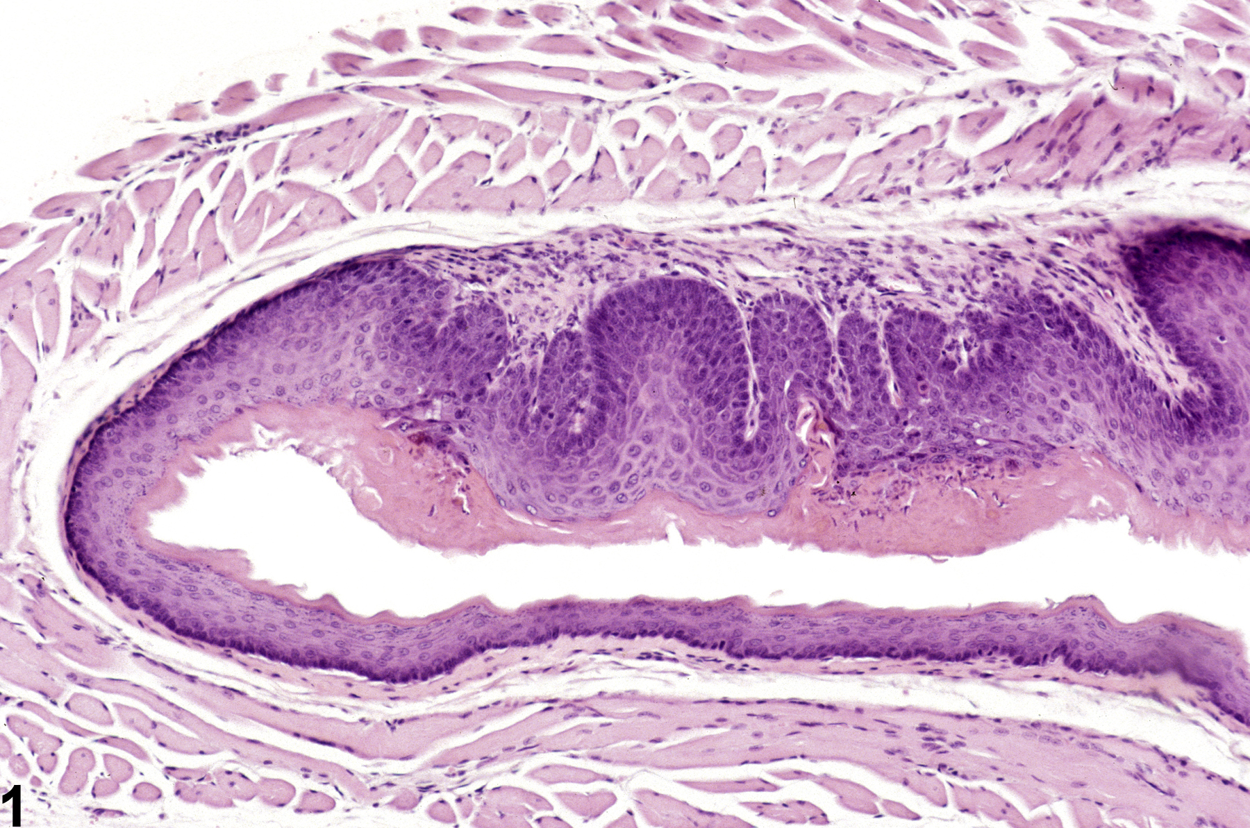 Image of hyperplasia in the esophagus from a female B6C3F1 mouse in a chronic study