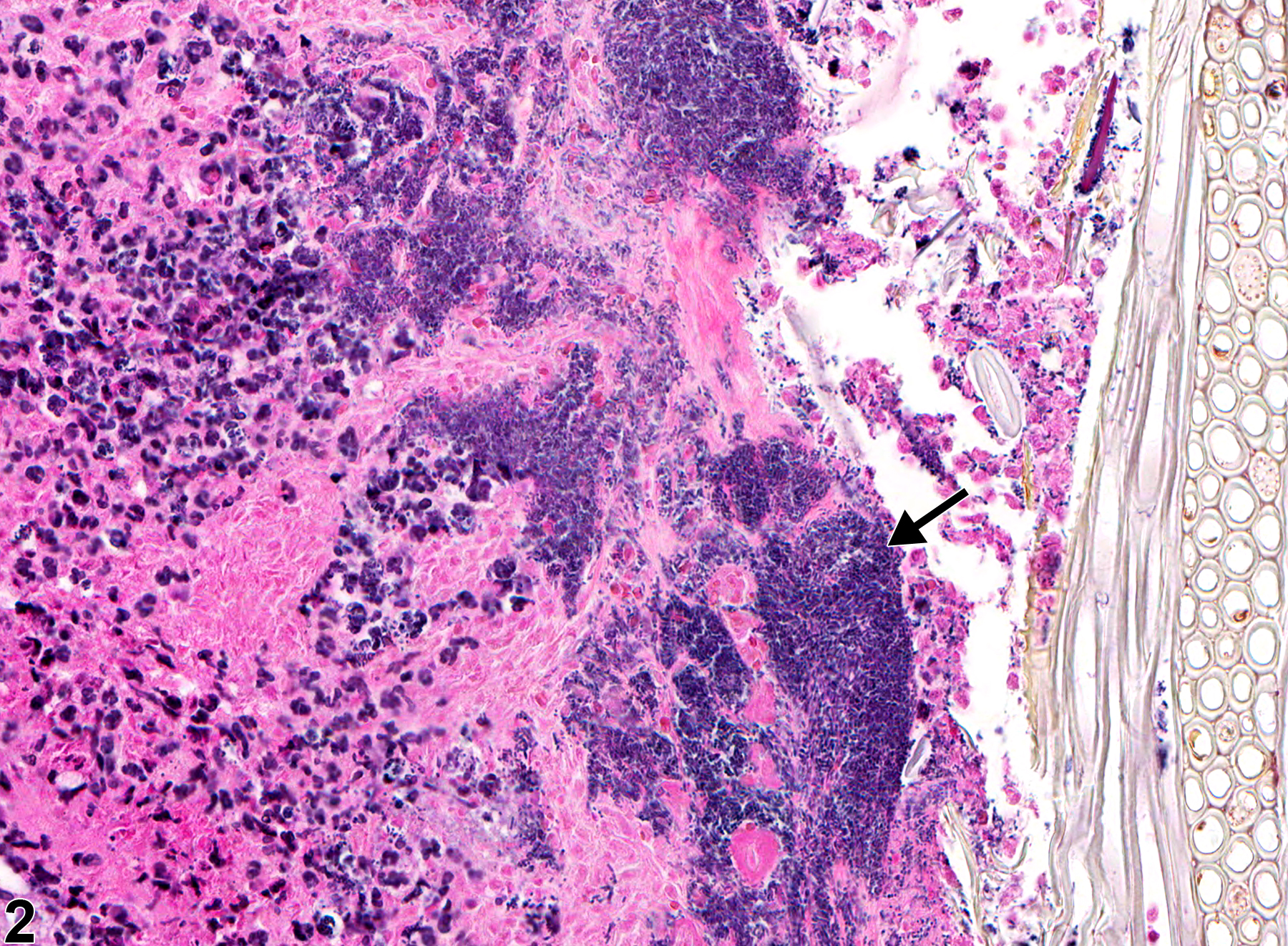 Image of inflammation in the esophagus from a female F344/N rat in a subchronic study