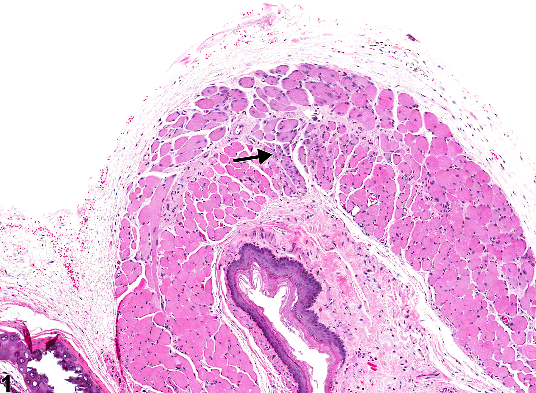 Image of degeneration in the esophagus muscularis from a male F344/N rat in a chronic study