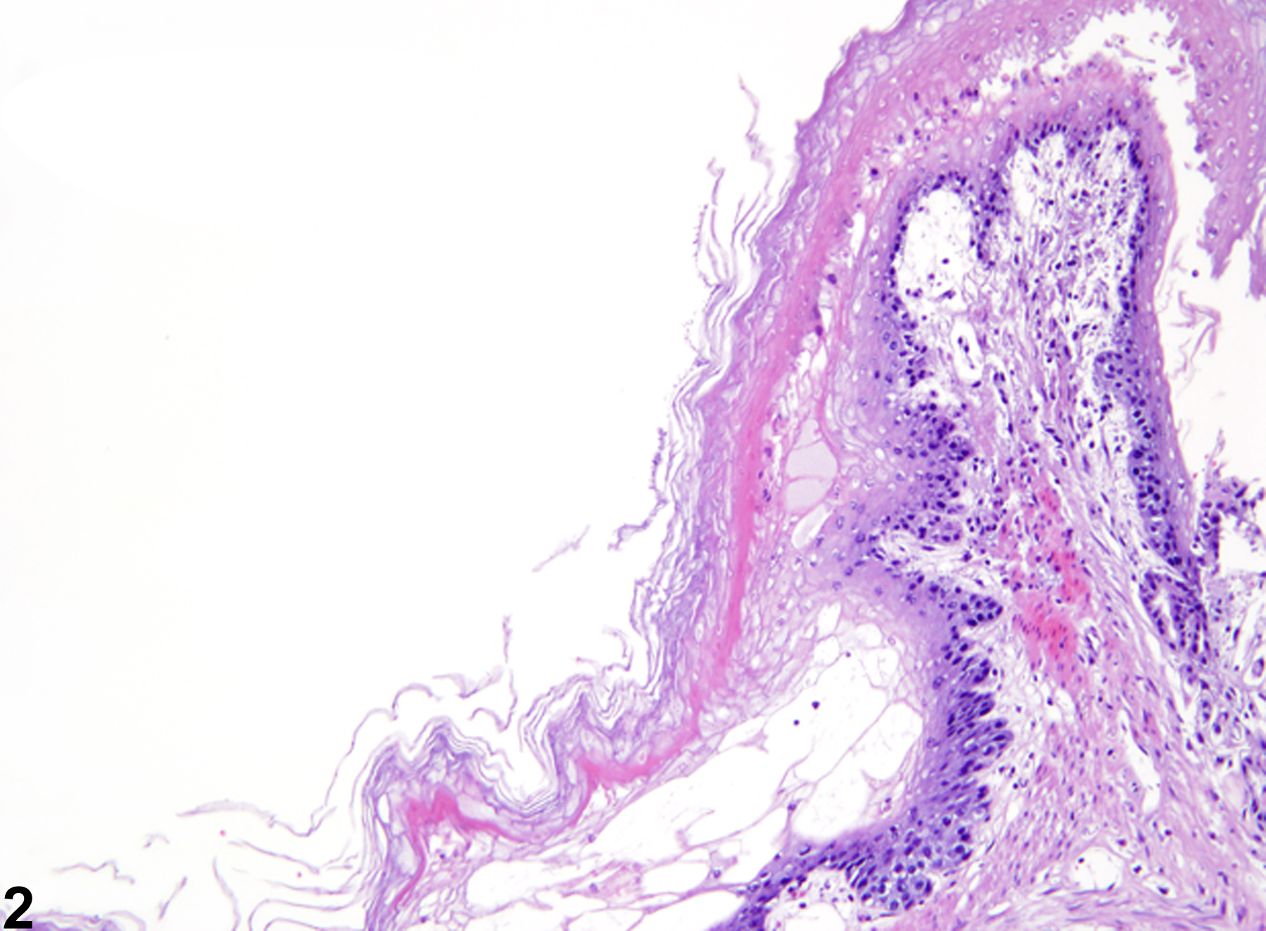Image of degeneration in the forestomach epithelium from a female F344/N rat in a subchronic study