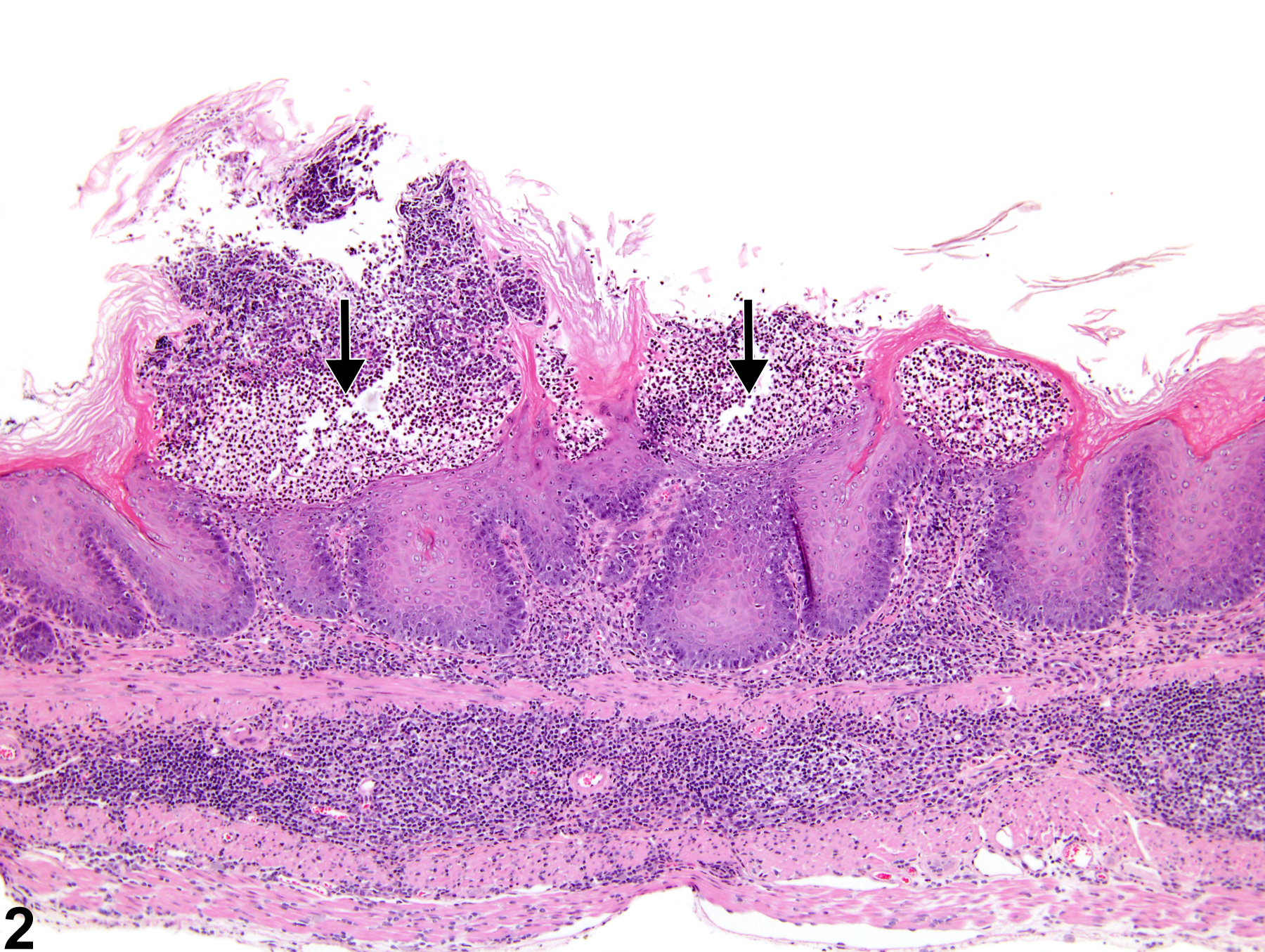 Image of erosion in the forestomach from a female B6C3F1 mouse in a chronic study