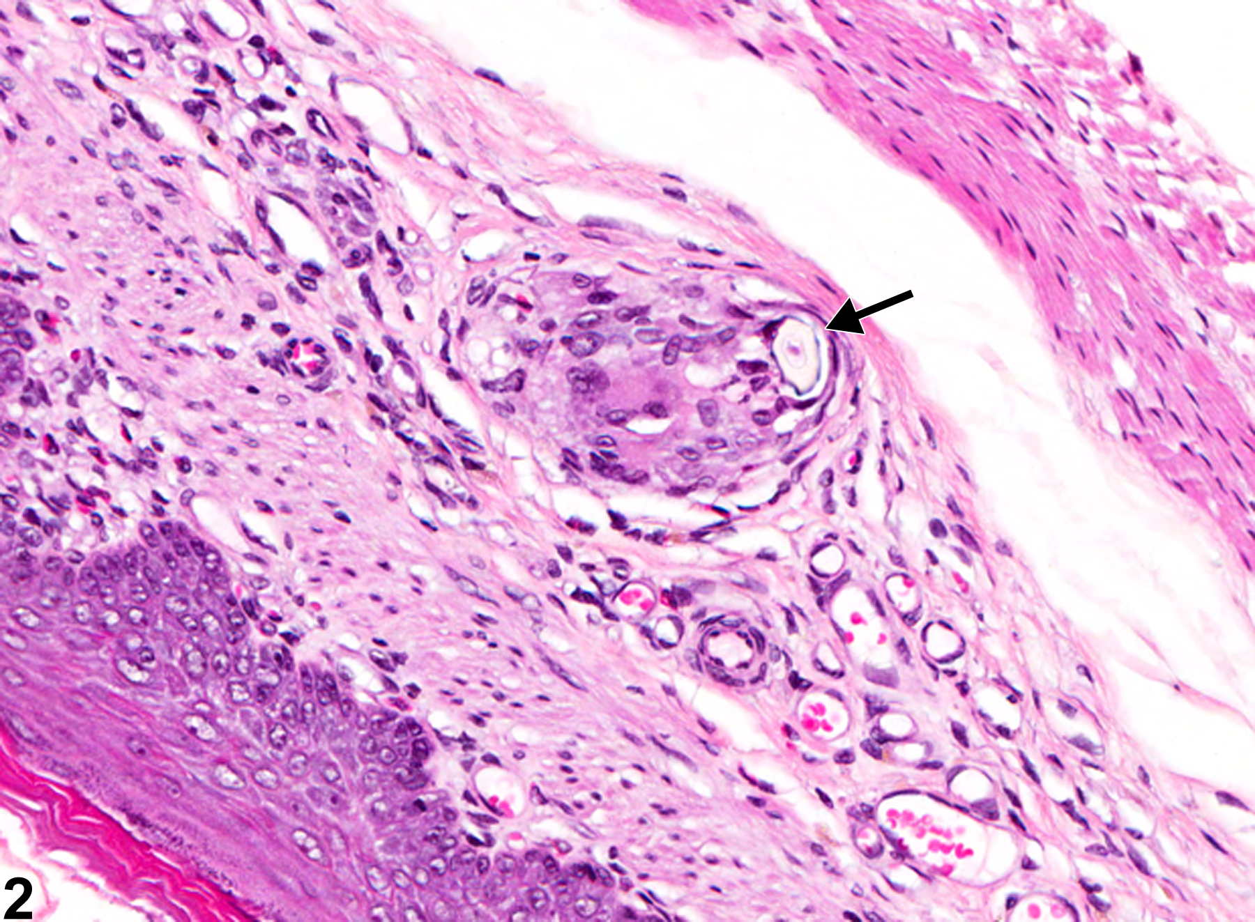 Image of foreign body in the forestomach from a male F344/N rat in a chronic study