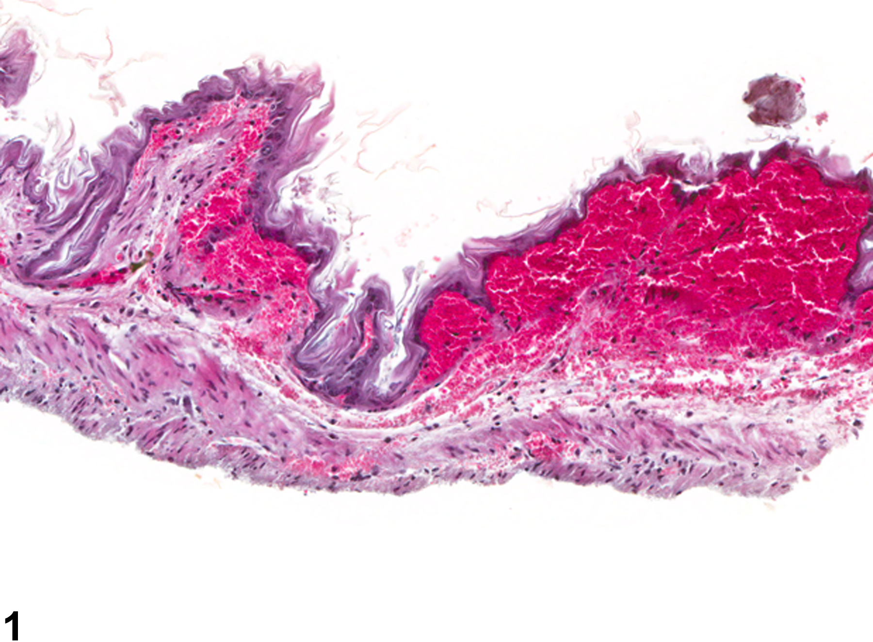 Image of hemorrhage in the forestomach from a female B6C3F1 mouse in a chronic study