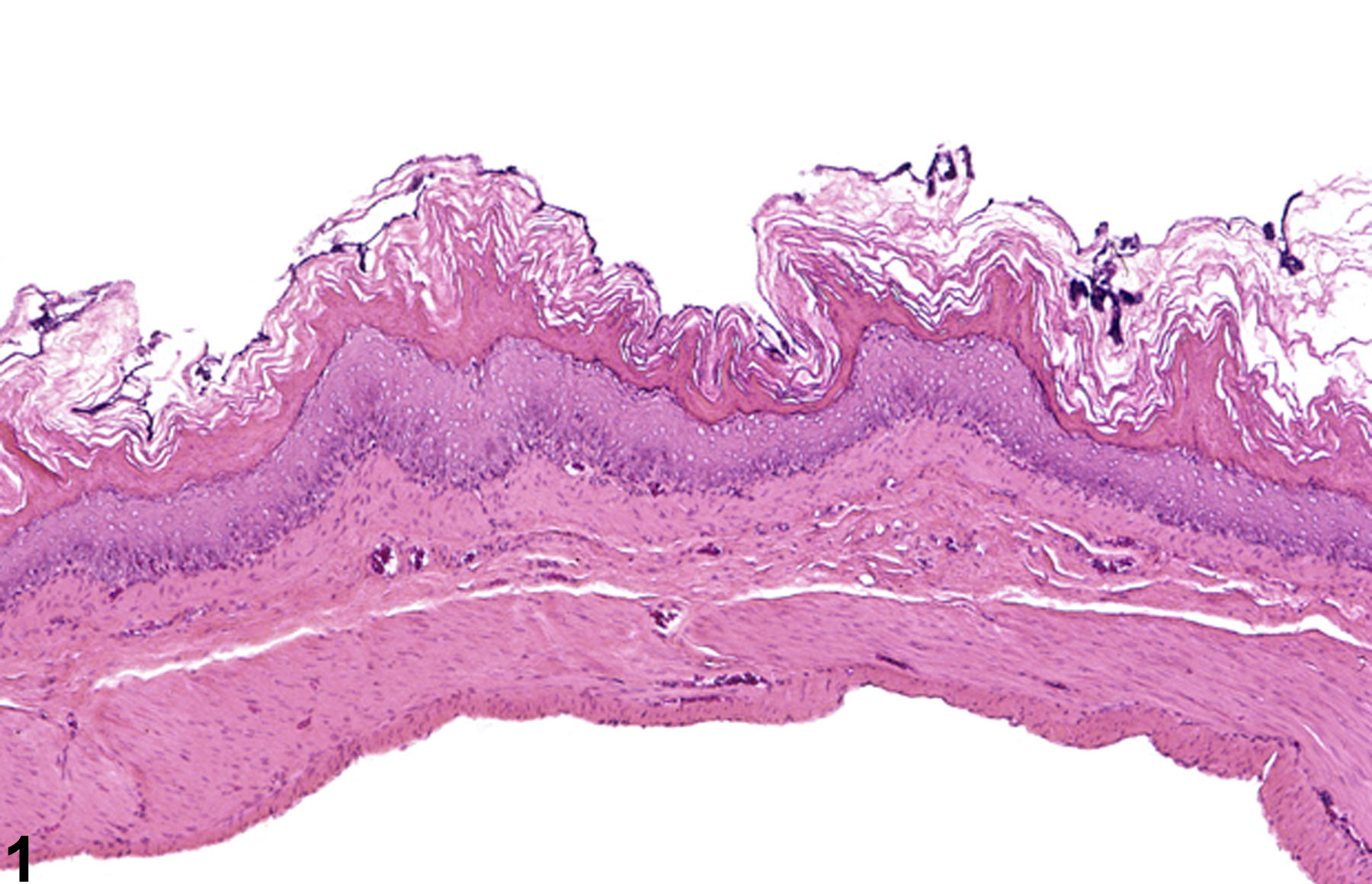Image of hyperkeratosis in the forestomach from a male F344/N rat in a subchronic study