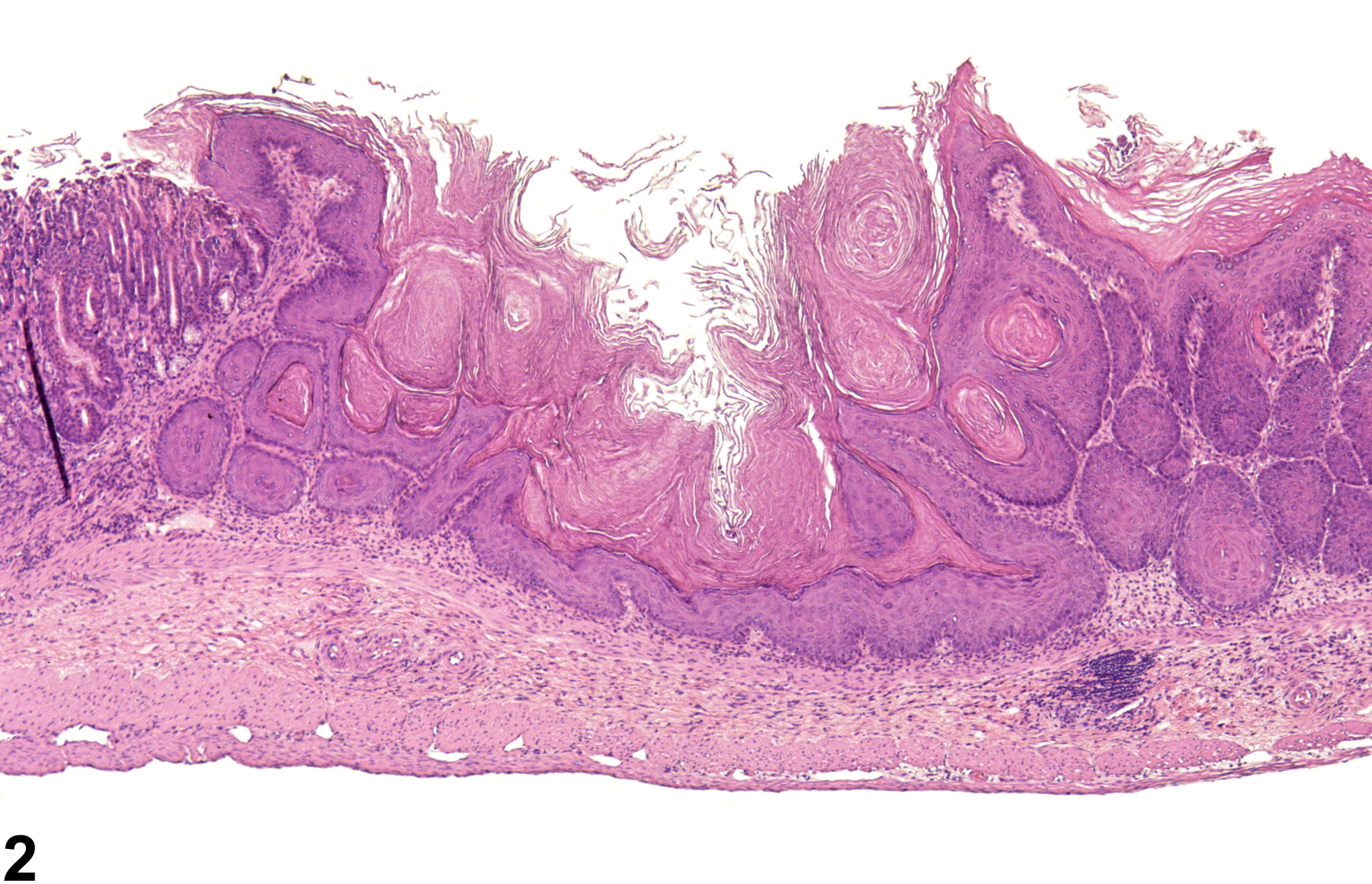 Image of hyperkeratosis in the forestomach from a male B6C3F1 mouse in a chronic study