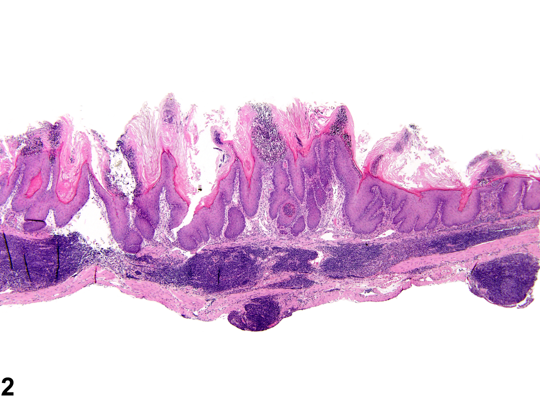 Image of inflammation in the forestomach from a female B6C3F1 mouse in a chronic study