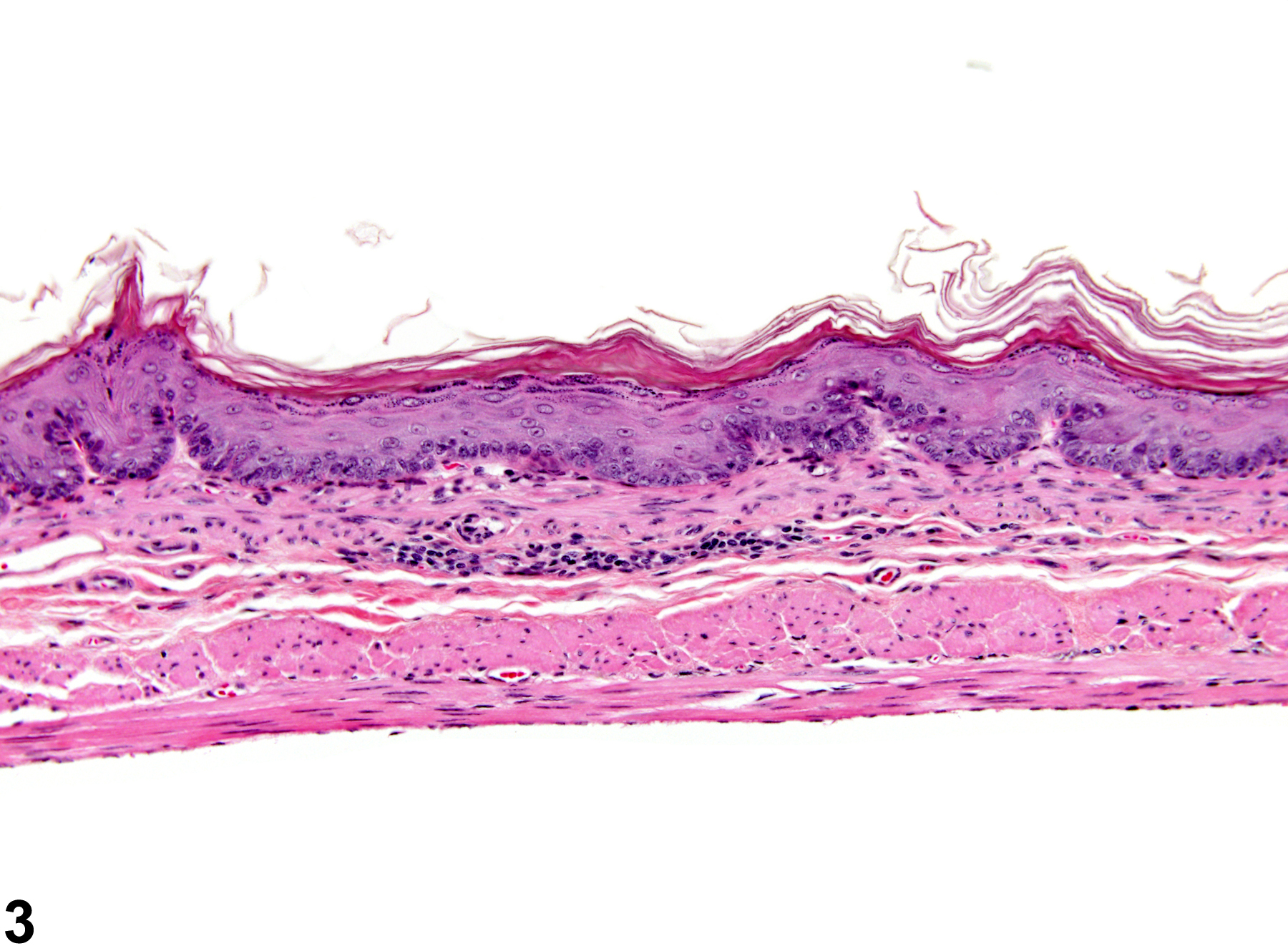 Image of inflammation in the forestomach from a female B6C3F1 mouse in a chronic study