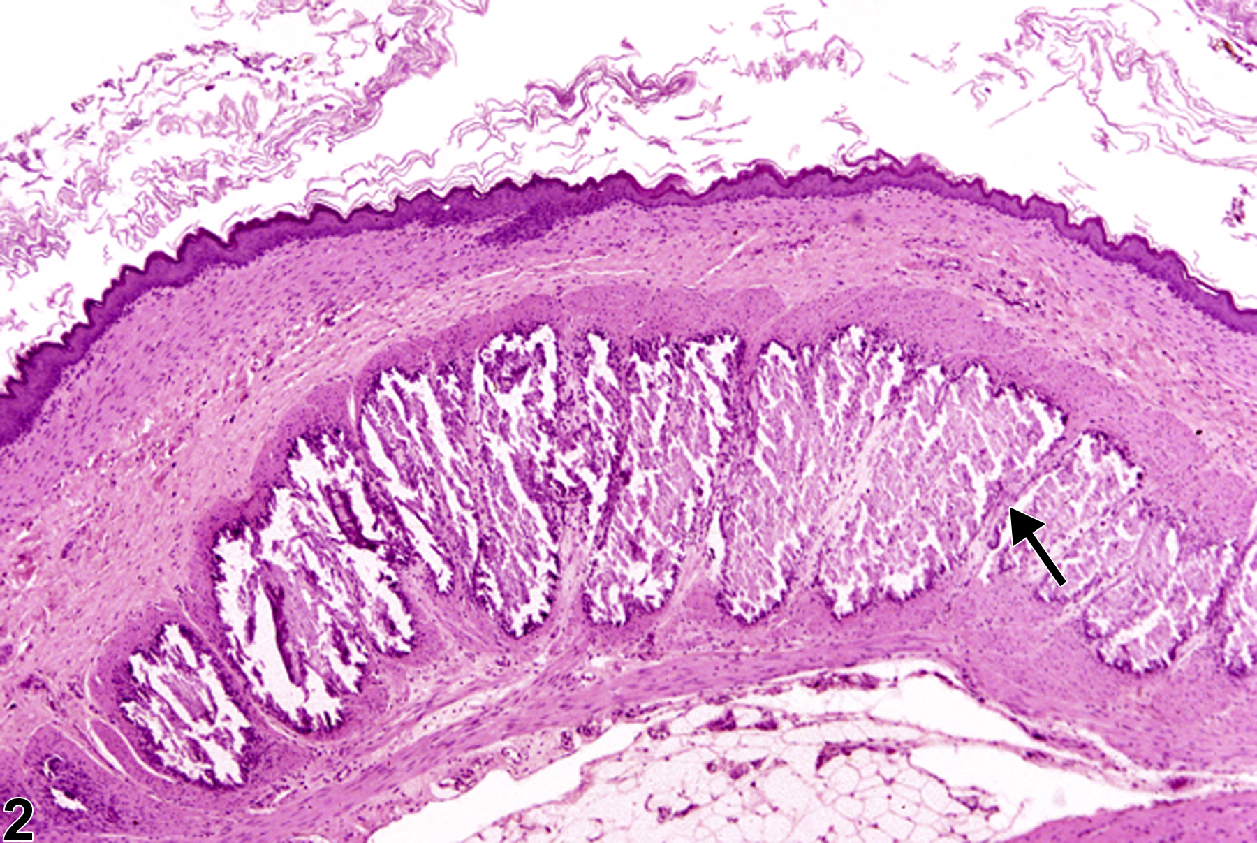 Image of mineralization in the forestomach from a male F344/N rat in a chronic study
