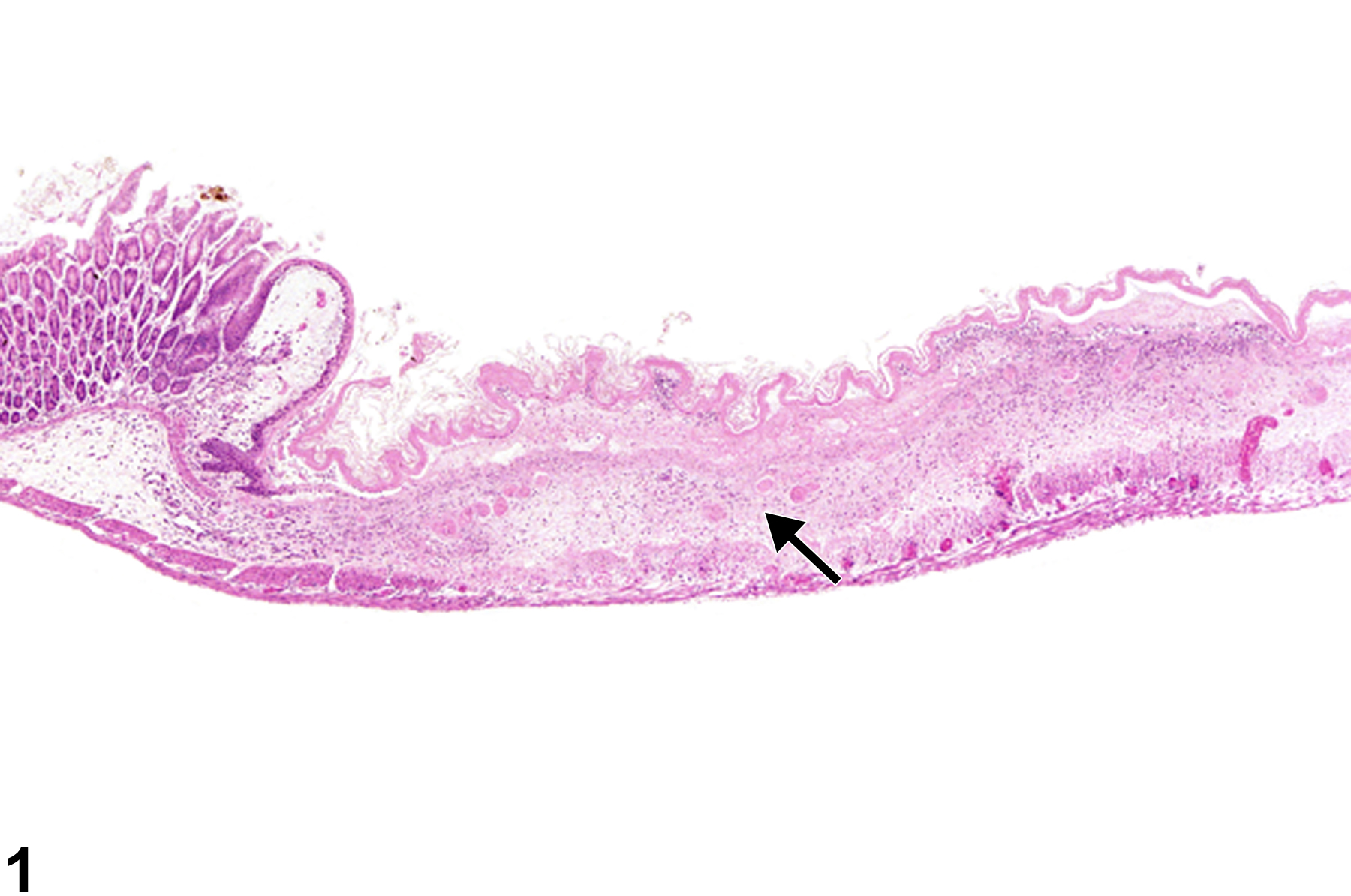 Image of necrosis in the forestomach from a female B6C3F1 mouse in a chronic study
