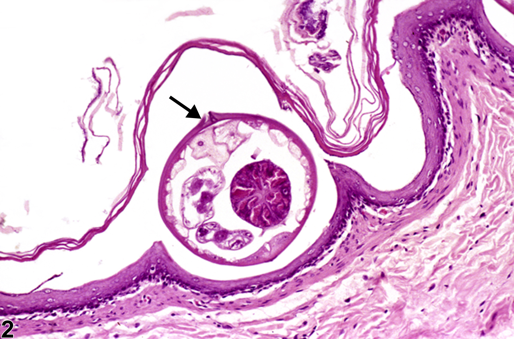 Image of parasite, metazoan in the forestomach from a male F344/N rat in a chronic study