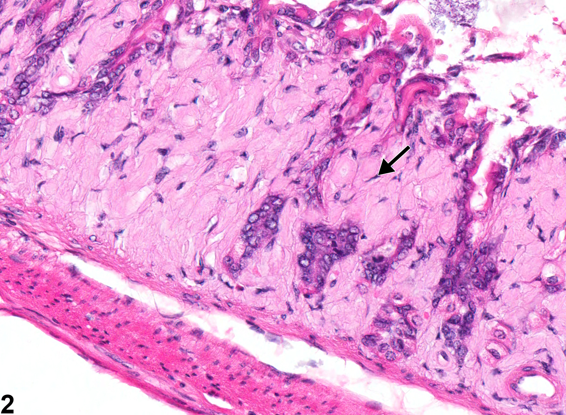 Image of amyloid in the glandular stomach from a female Swiss Webster mouse in a chronic study