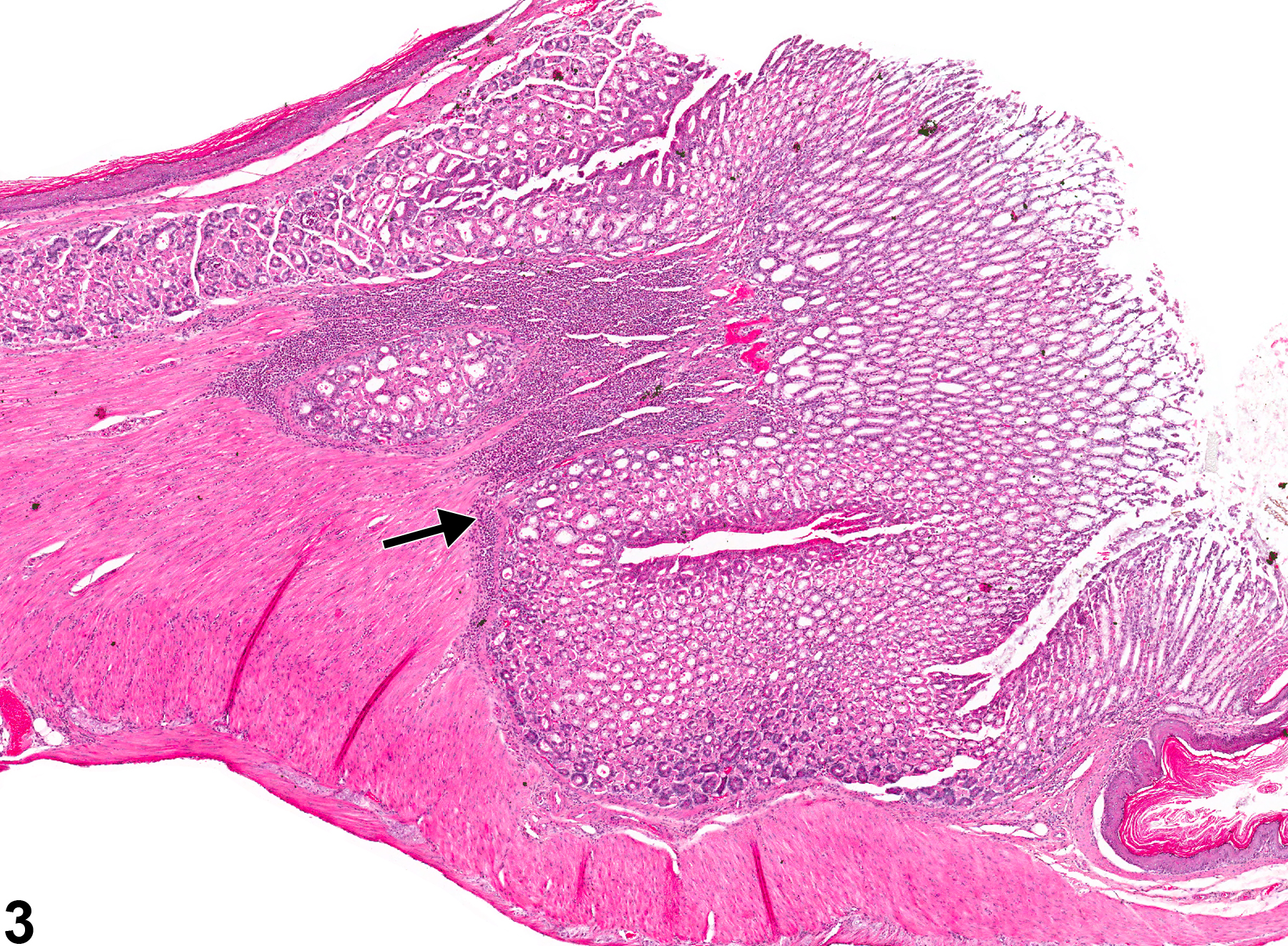 Image of inflammation in the glandular stomach from a male B6C3F1 mouse in a chronic study