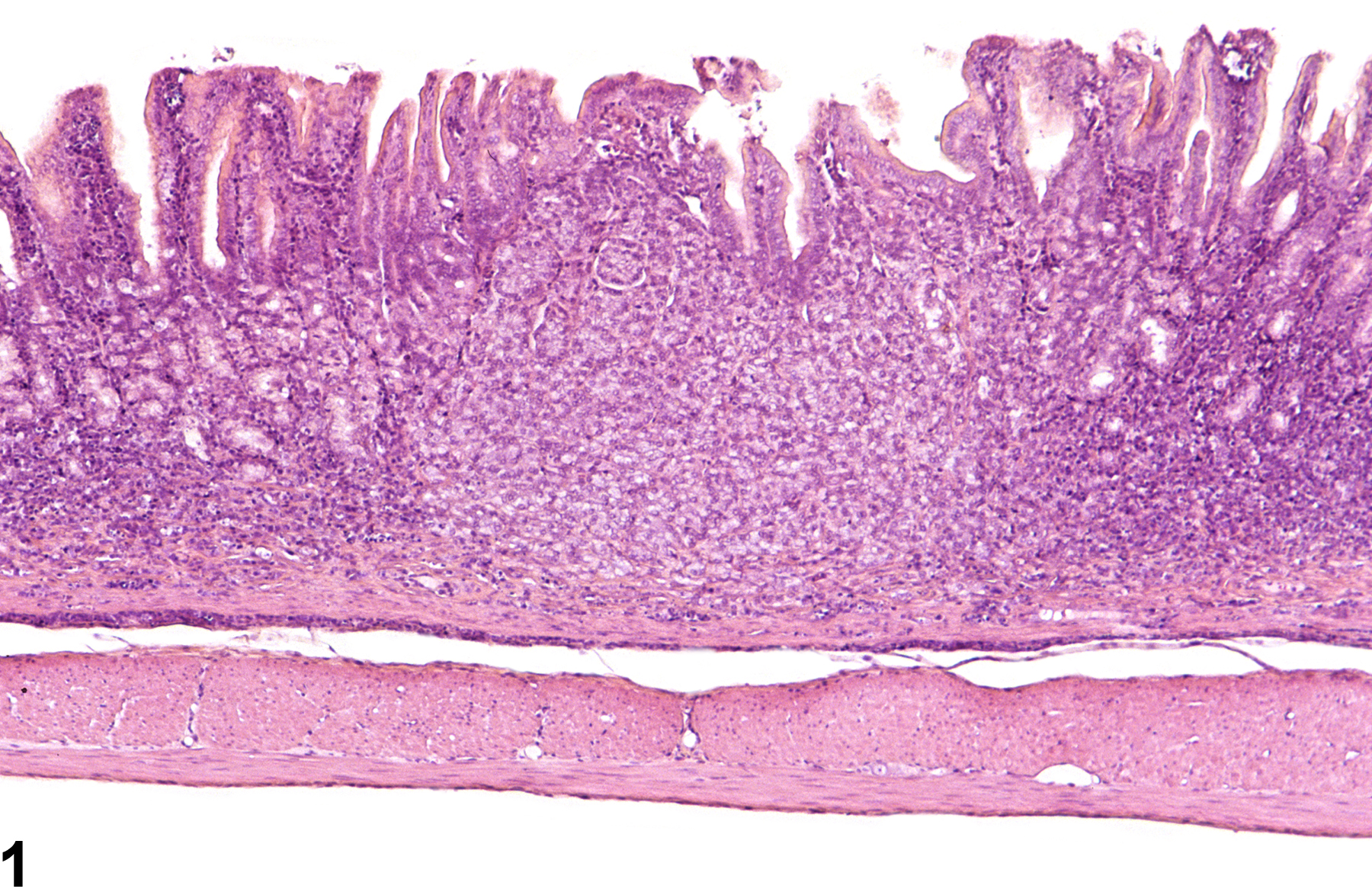 Image of hyperplasia in the glandular stomach neuroendocrine cell from a female F344/N rat in a chronic study