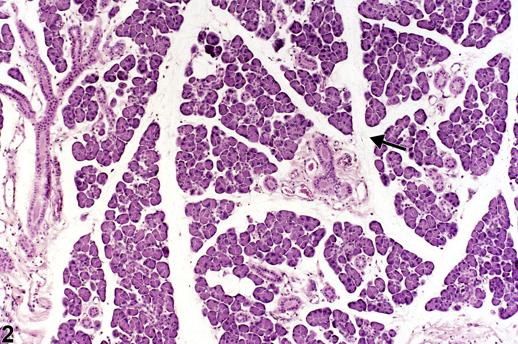 Image of edema in the salivary gland from a male F344/N rat in a chronic study