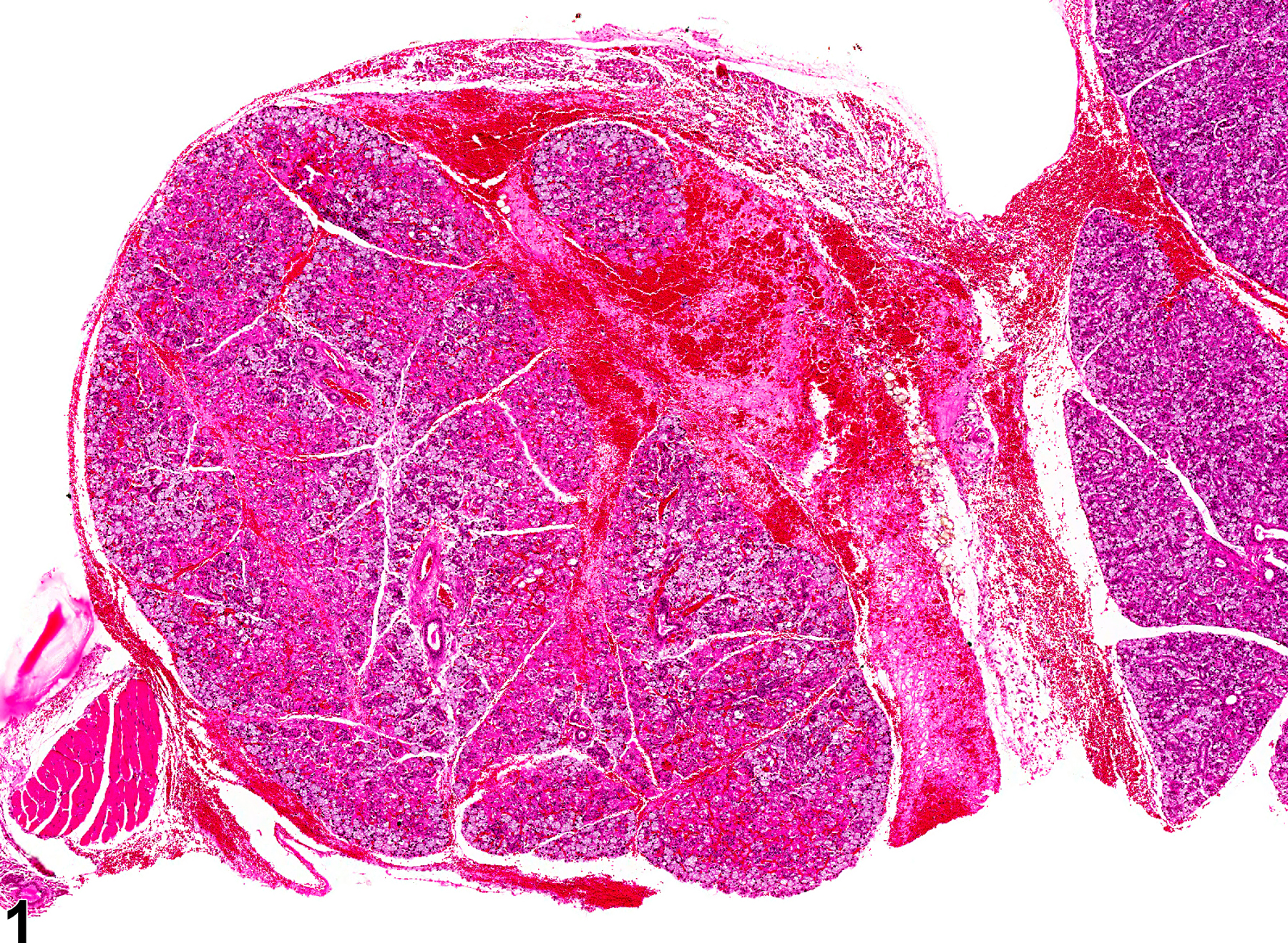 Image of hemorrhage in the salivary gland from a female B6C3F1 mouse in a chronic study