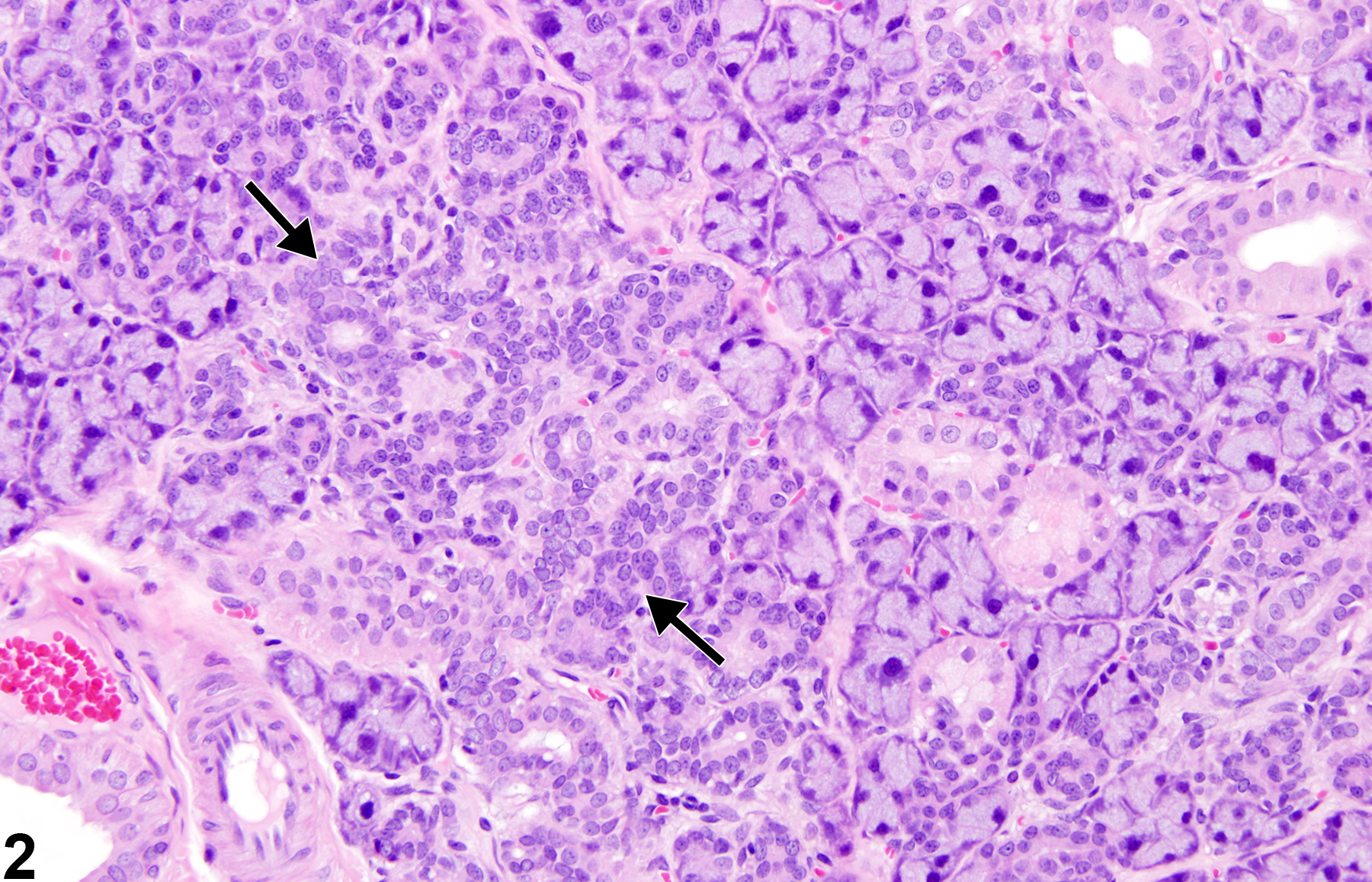 Image of hyperplasia in the salivary gland from a male F344/N rat in a subchronic study