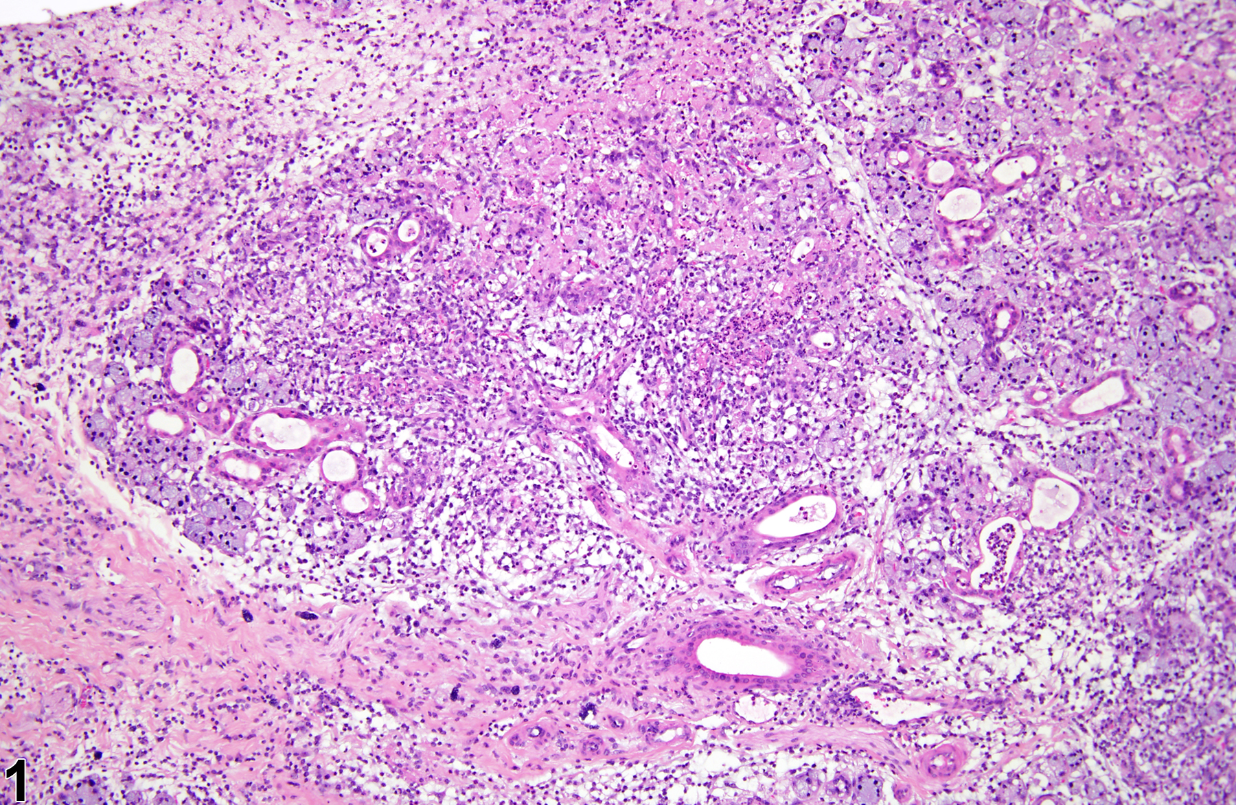 Image of necrosis in the salivary gland from a male F344/N rat in a subchronic study
