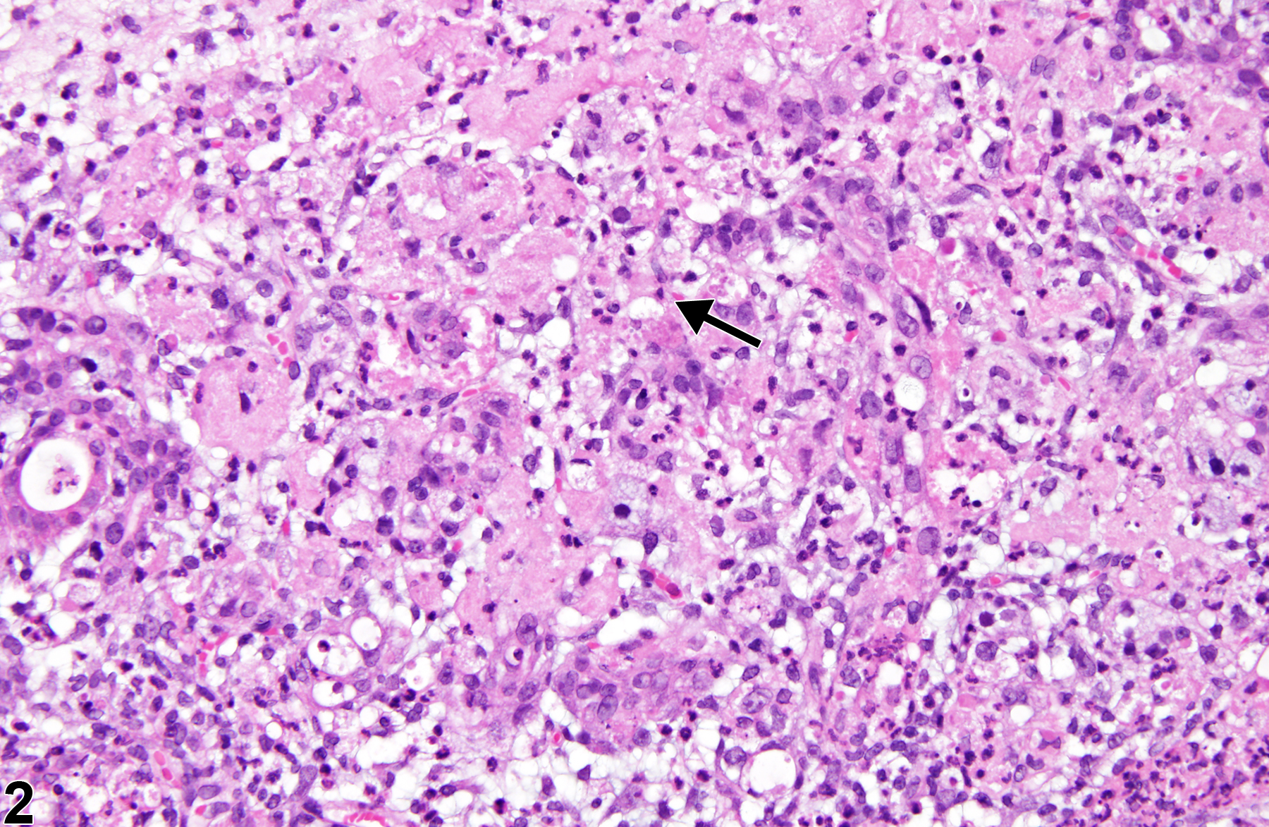 Image of necrosis in the salivary gland from a male F344/N rat in a subchronic study