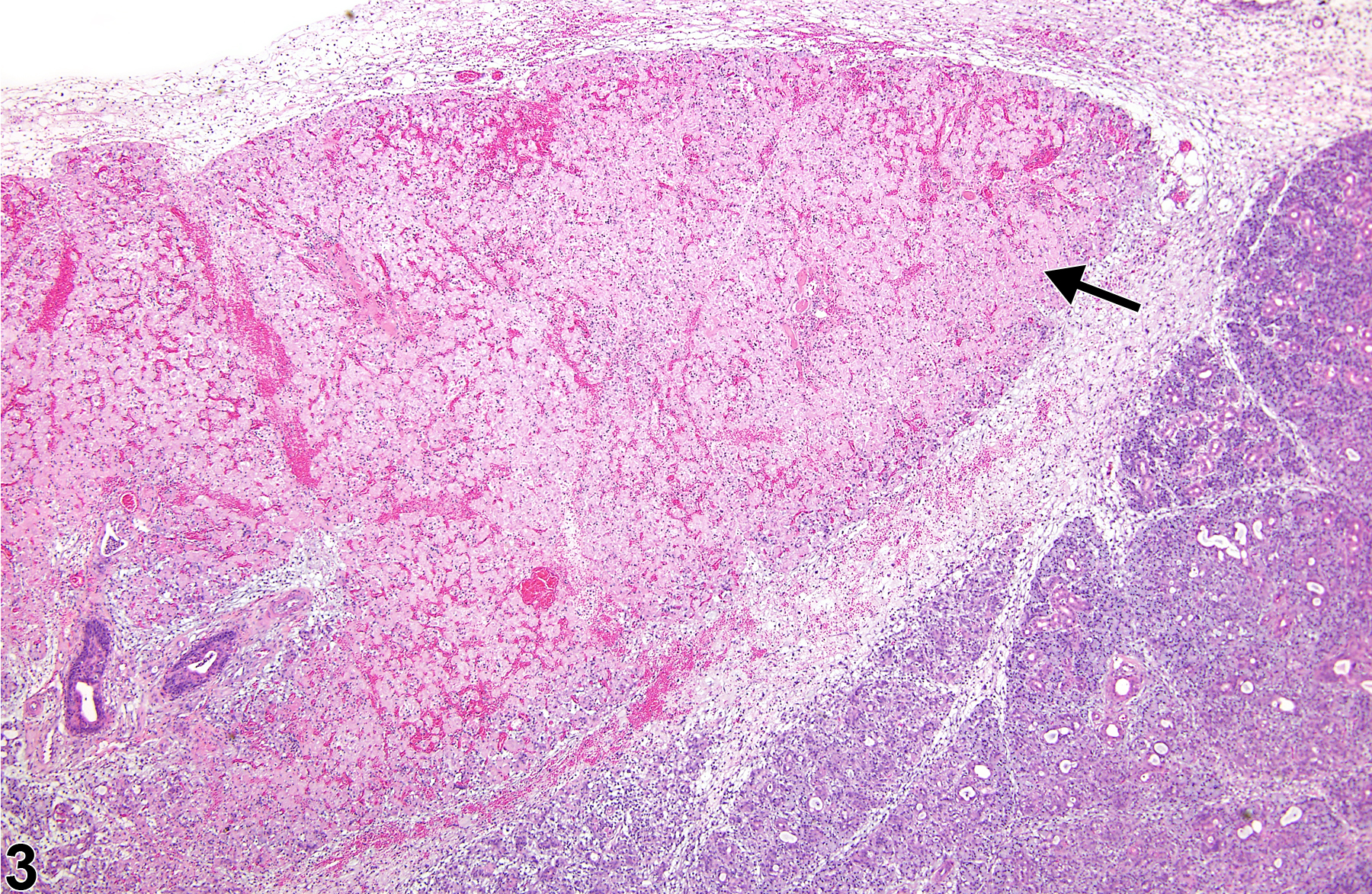Image of necrosis in the salivary gland from a female F344/N rat in a subchronic study