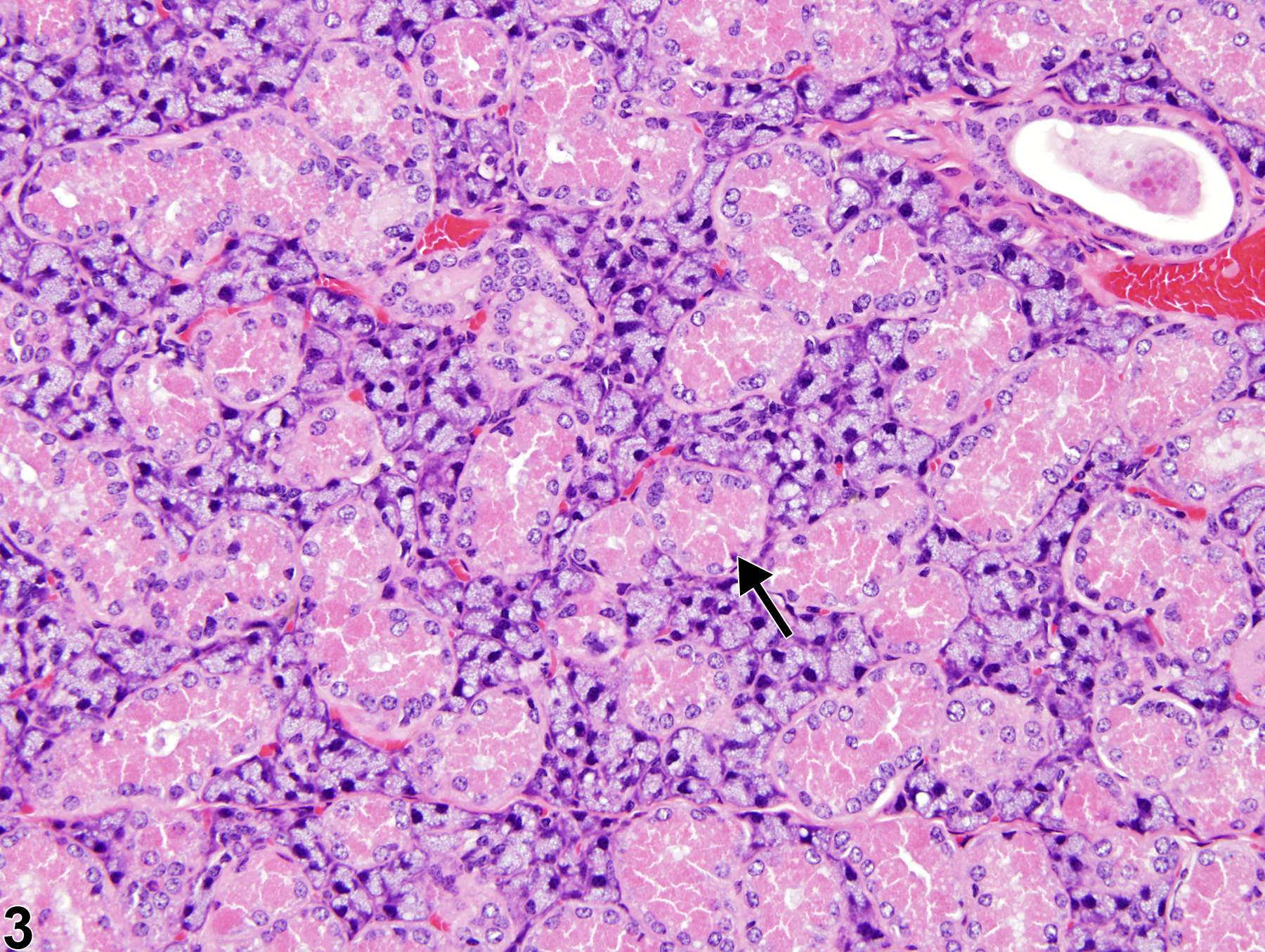 Image of cytoplasmic alteration in the submandibular salivary gland duct from a female B6C3F1 mouse in a chronic study