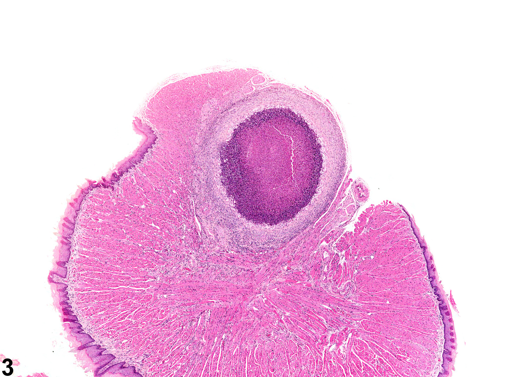 Image of inflammation in the tongue from a male F344/N rat in a chronic study