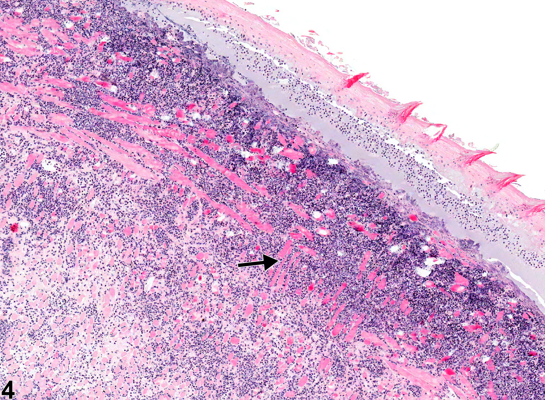 Image of necrosis in the tongue from a male Swiss CD-1 mouse in a chronic study