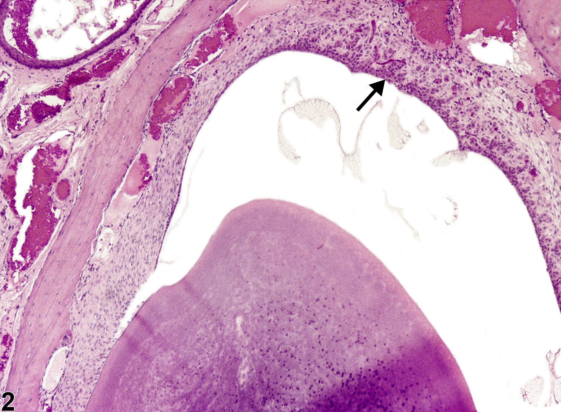 Image of metaplasia, squamous in the tooth ameloblast from a male F344/N rat in a chronic study