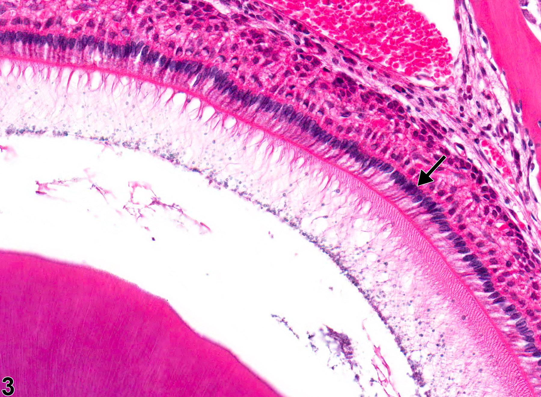 Image of normal ameloblast comparison to metaplasia, squamous in the tooth from a male B6C3F1 mouse in a chronic study