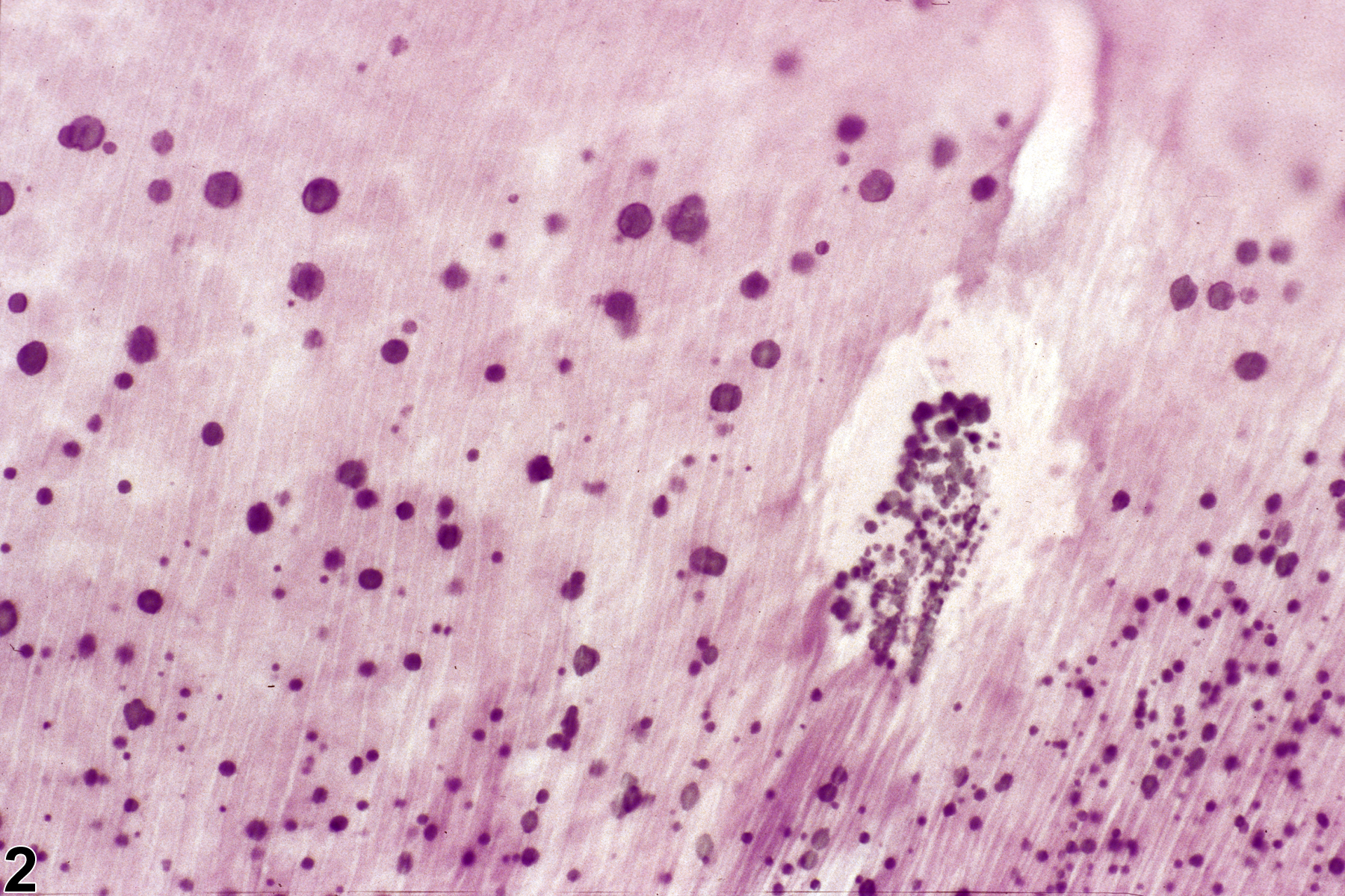 Image of baspholic granules in the tooth from a male F344/N rat in a chronic study