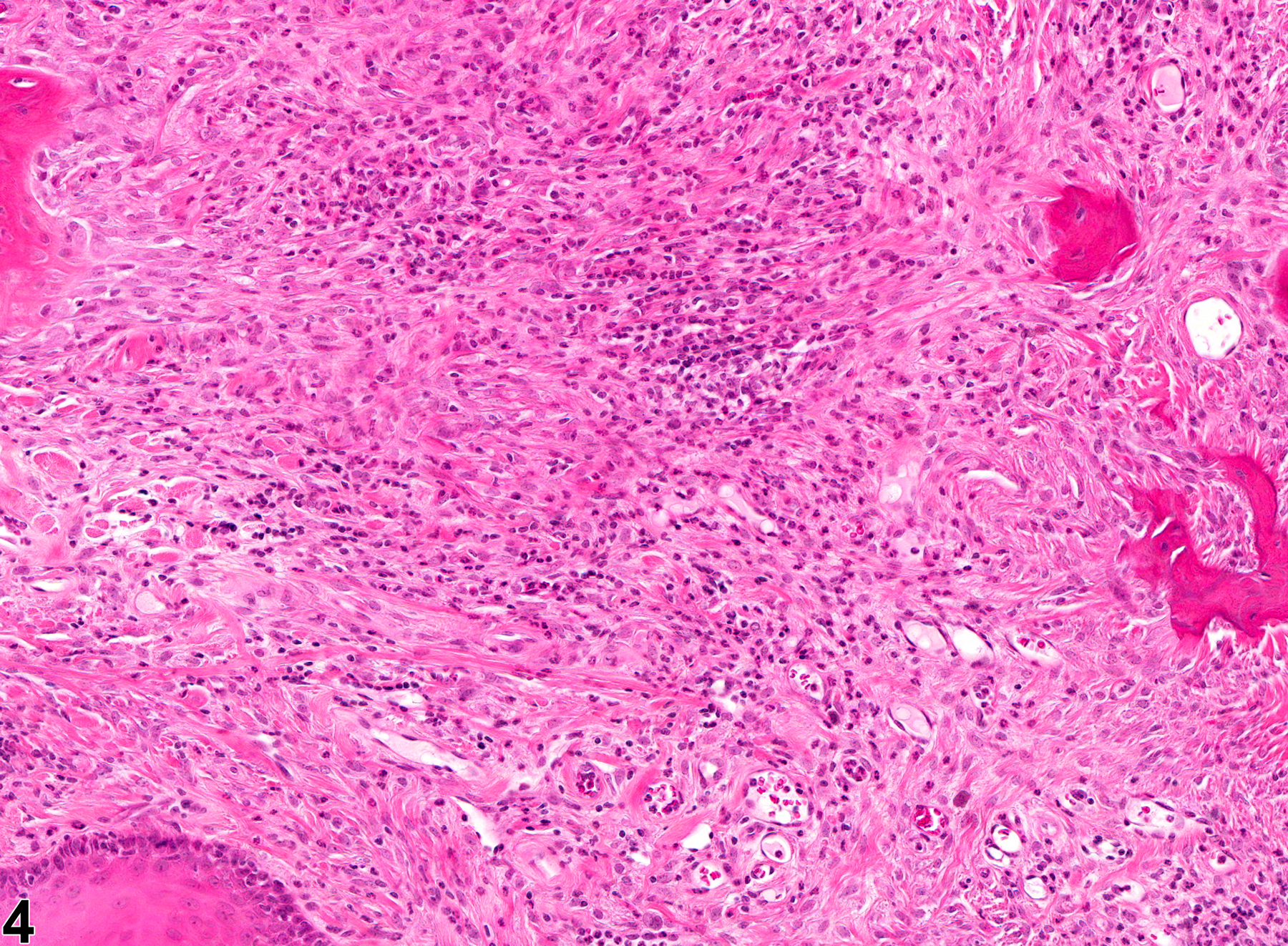 Image of fibrosis in the tooth from a female B6C3F1 mouse in a chronic study