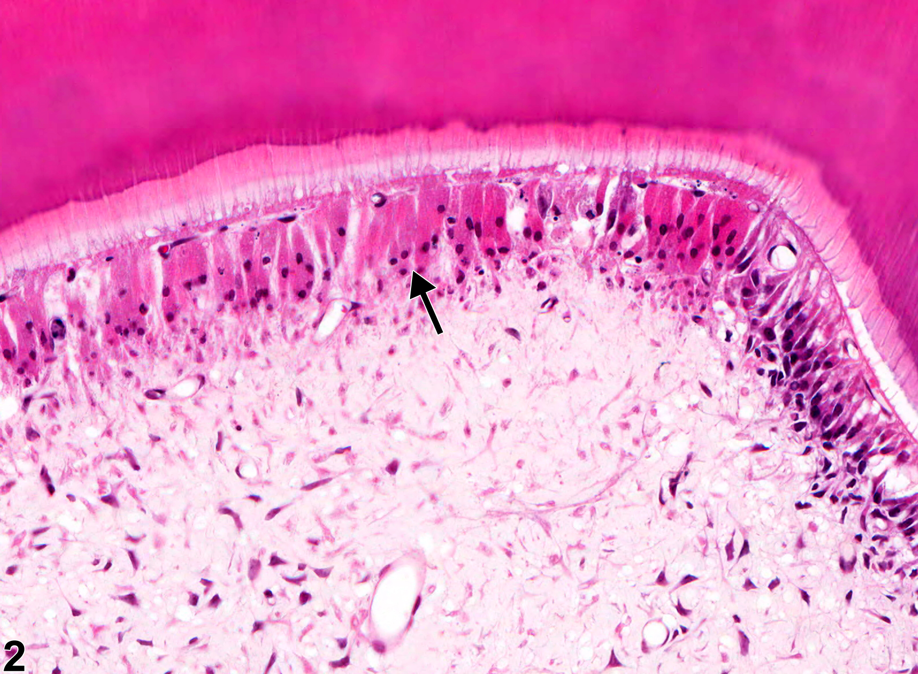 Image of necrosis in the tooth from a female F344/N rat in a subchronic study