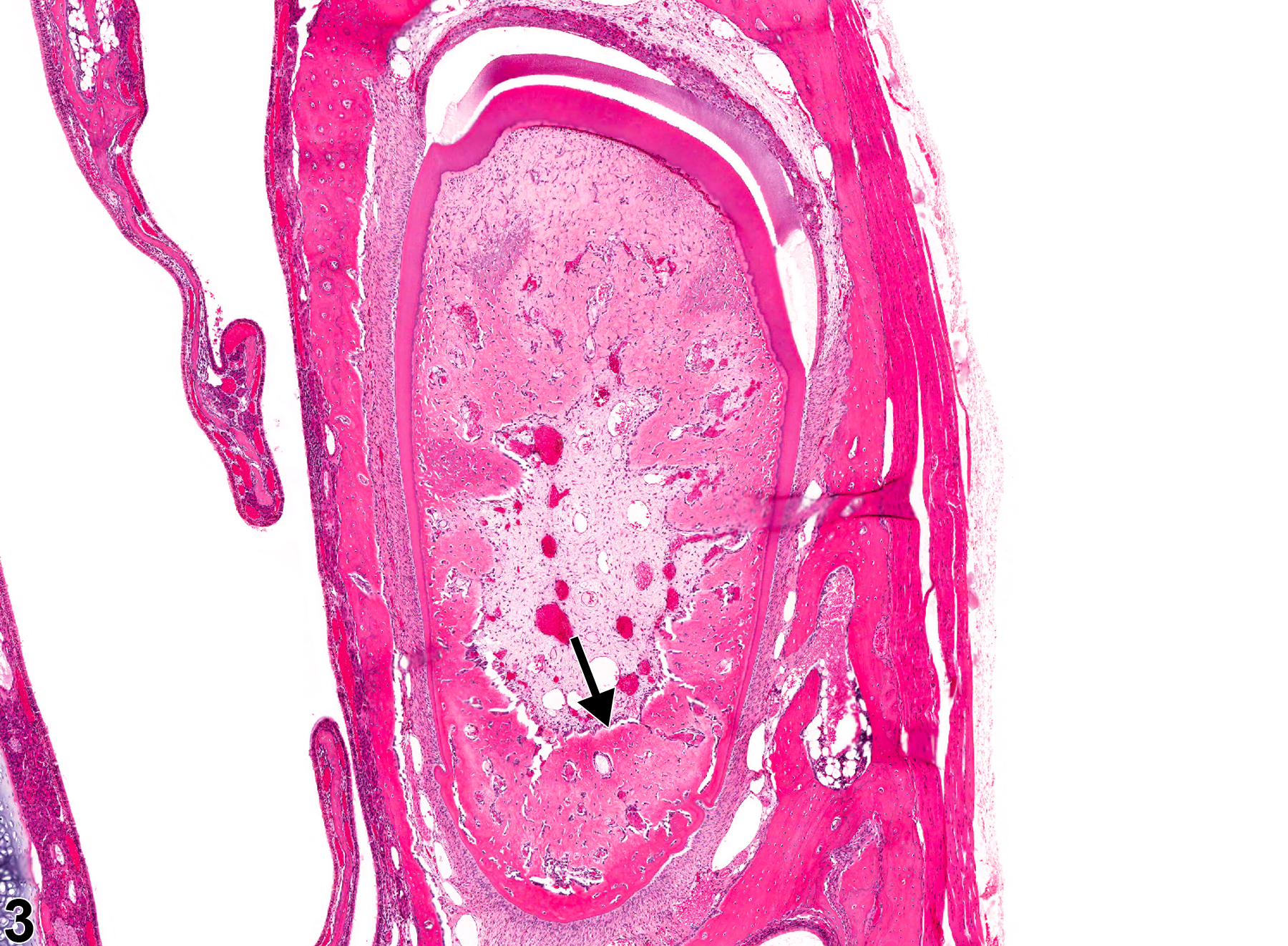 Image of osteodentin in the tooth pulp from a female F344/N rat in a subchronic study