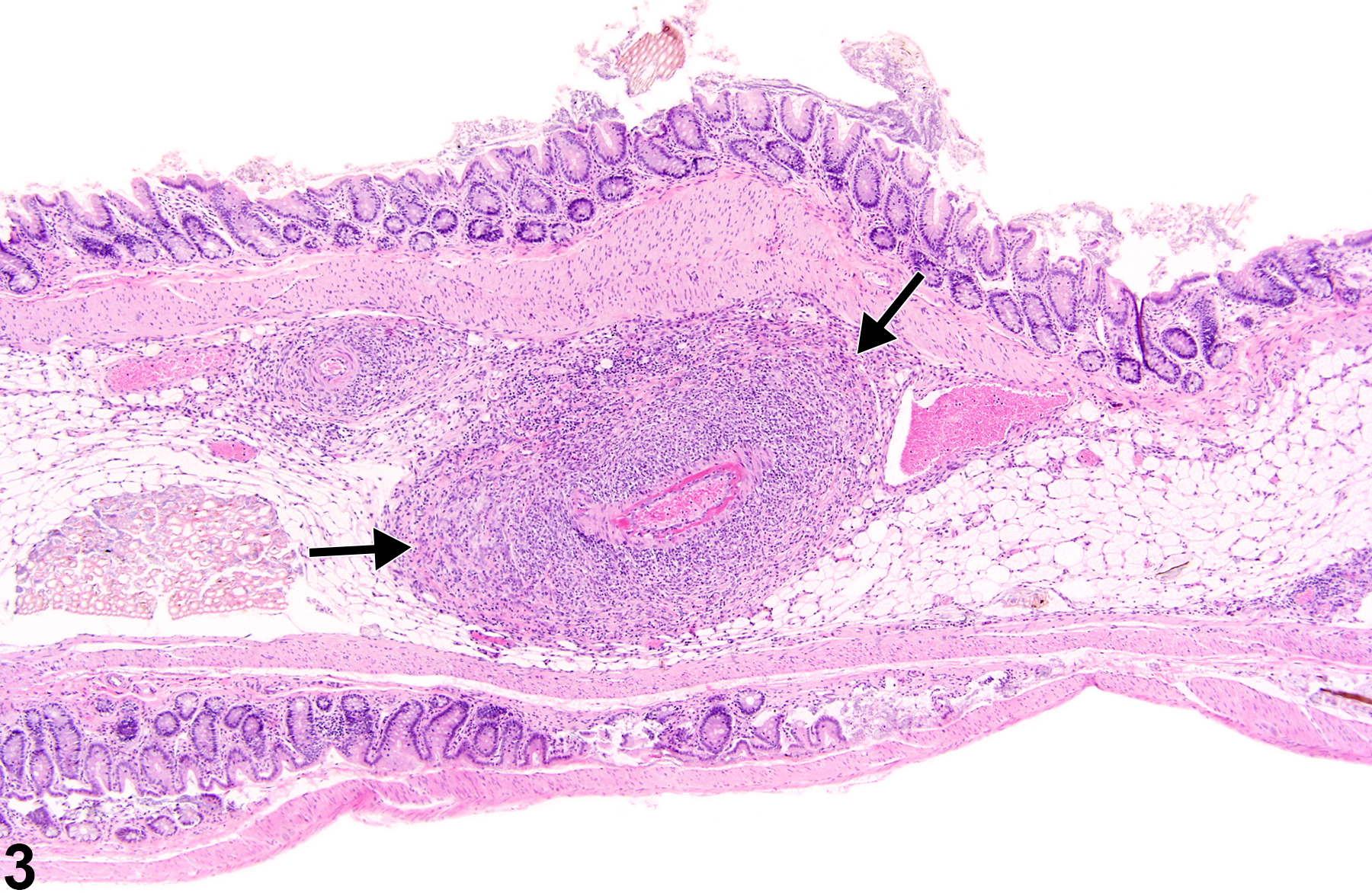 Image of polyarteritis nodosa in the stomach, glandular stomach from a male B6C3F1/N mouse in a chronic study