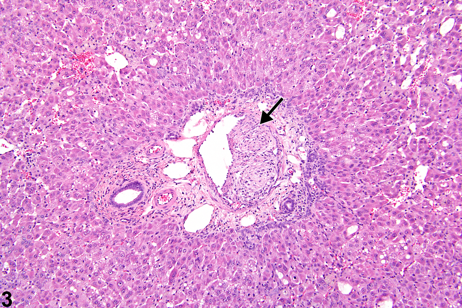 Image of proliferation, intimal in the liver, artery from a female F344/N rat in a subchronic study