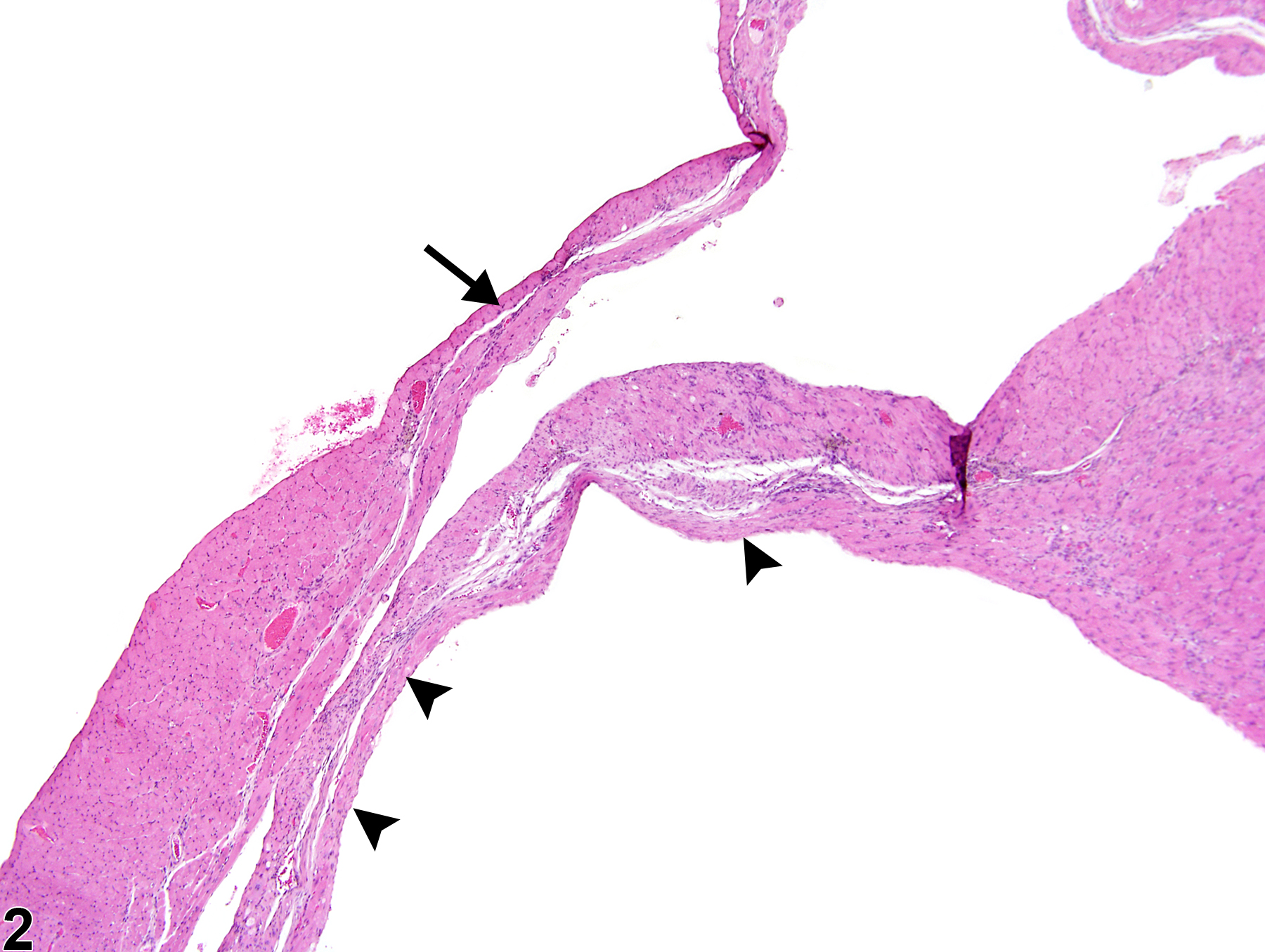Image of atrophy in the heart from a male B6C3F1/N mouse in a chronic study