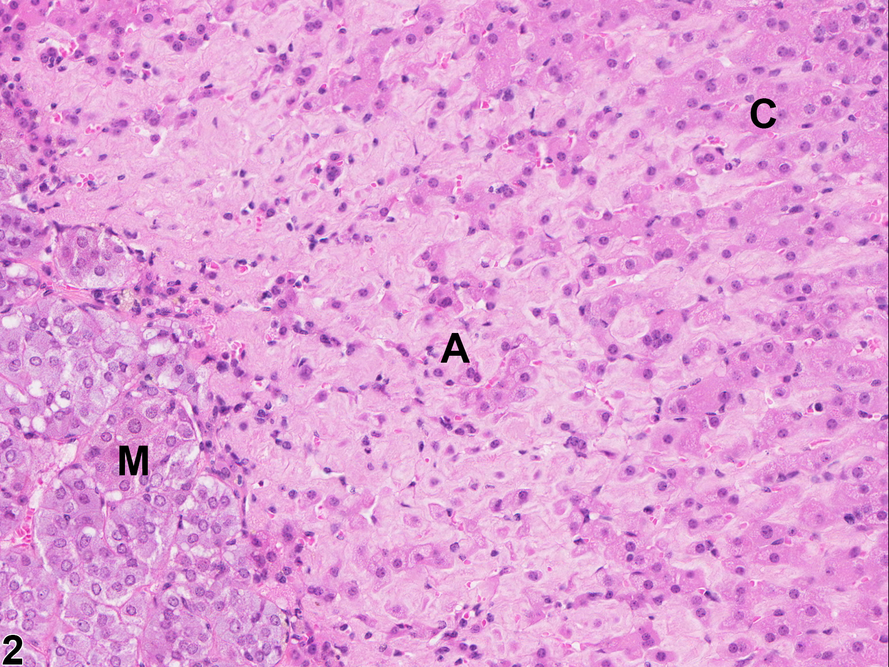 Image of amyloid in the adrenal gland from a male B6C3F1/N mouse in a chronic study
