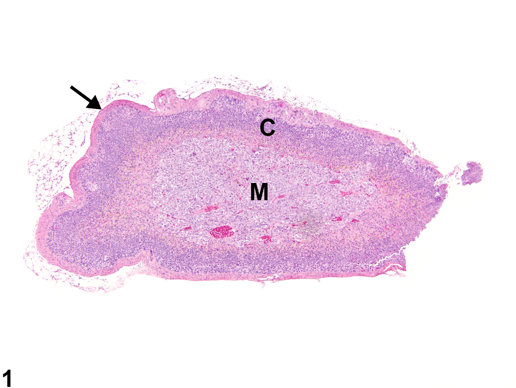 Image of atrophy in the adrenal gland cortex from a female Sprague-Dawley rat in a chronic study