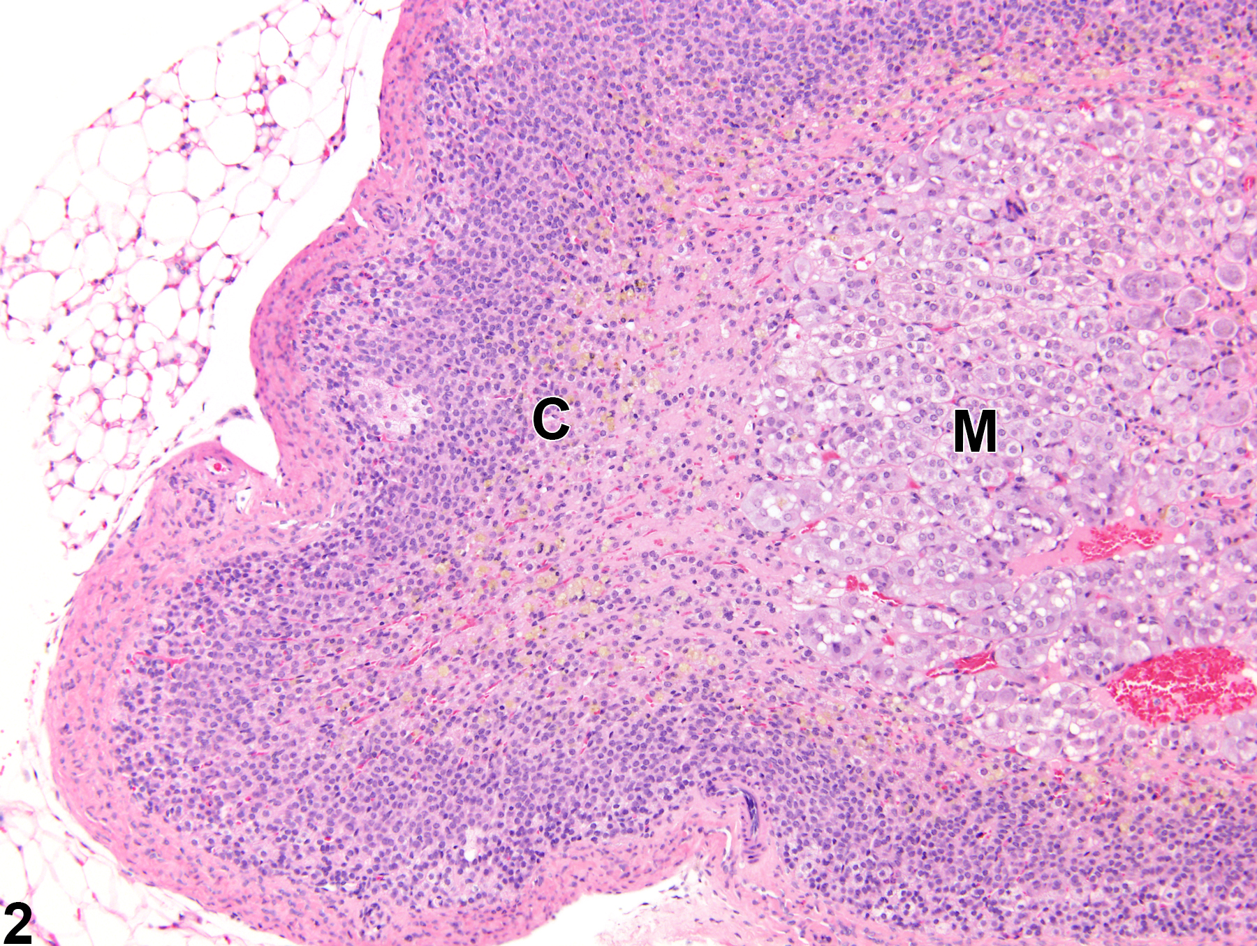 Image of atrophy in the adrenal gland cortex from a female Sprague-Dawley rat in a chronic study