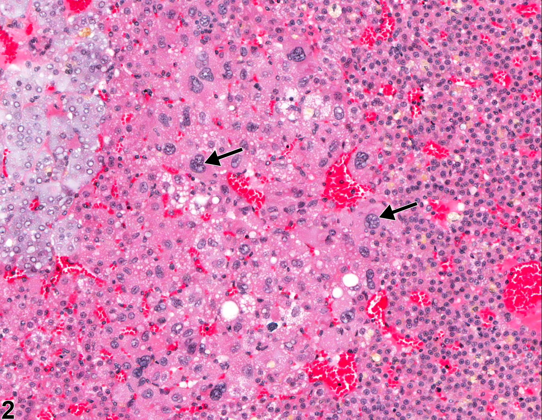 Image of cellular atypia in the adrenal gland cortex from a female F344/N rat in a chronic study