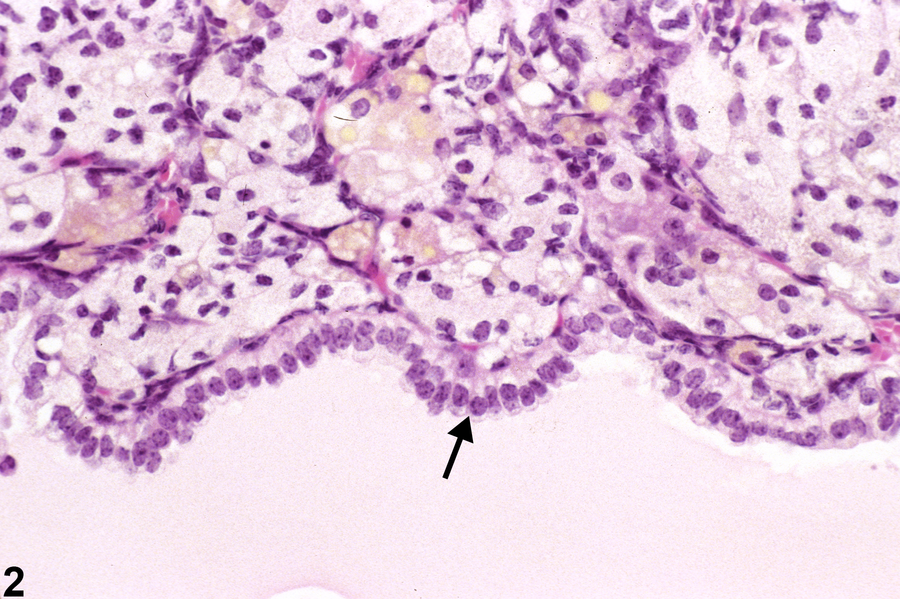 Image of cyst in the adrenal gland from a female B6C3F1/N mouse in a chronic study