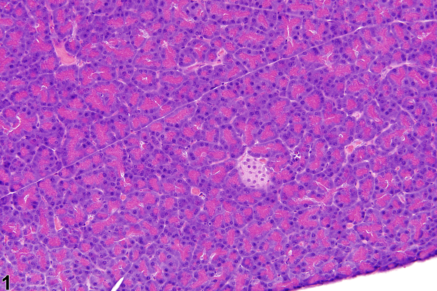 Image of hypoplasia in the pancreatic islet from a female F344/N rat in a chronic study