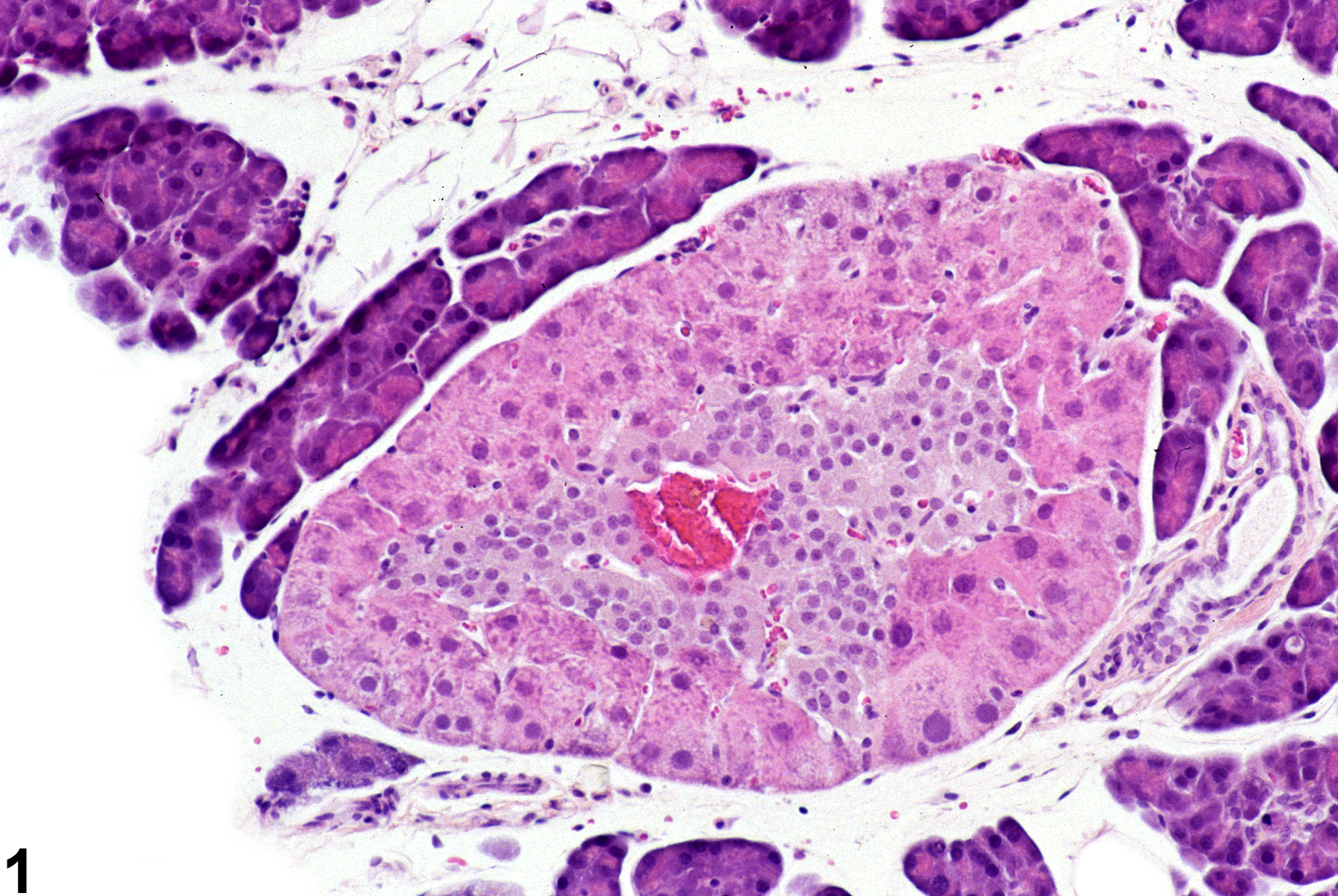 Image of metaplasia, hepatocyte in the pancreatic islet from a female F344/N rat in a subchronic study
