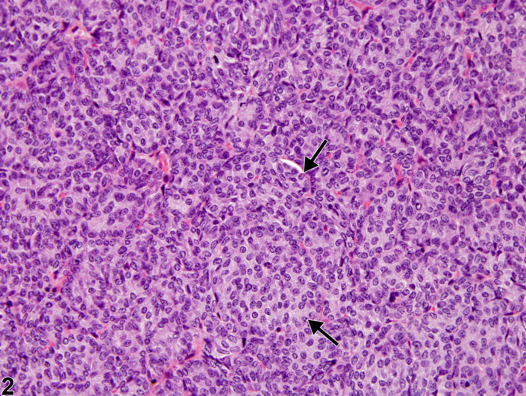 Image of hyperplasia, diffuse in the parathyroid gland from a male F344/N rat in a chronic study