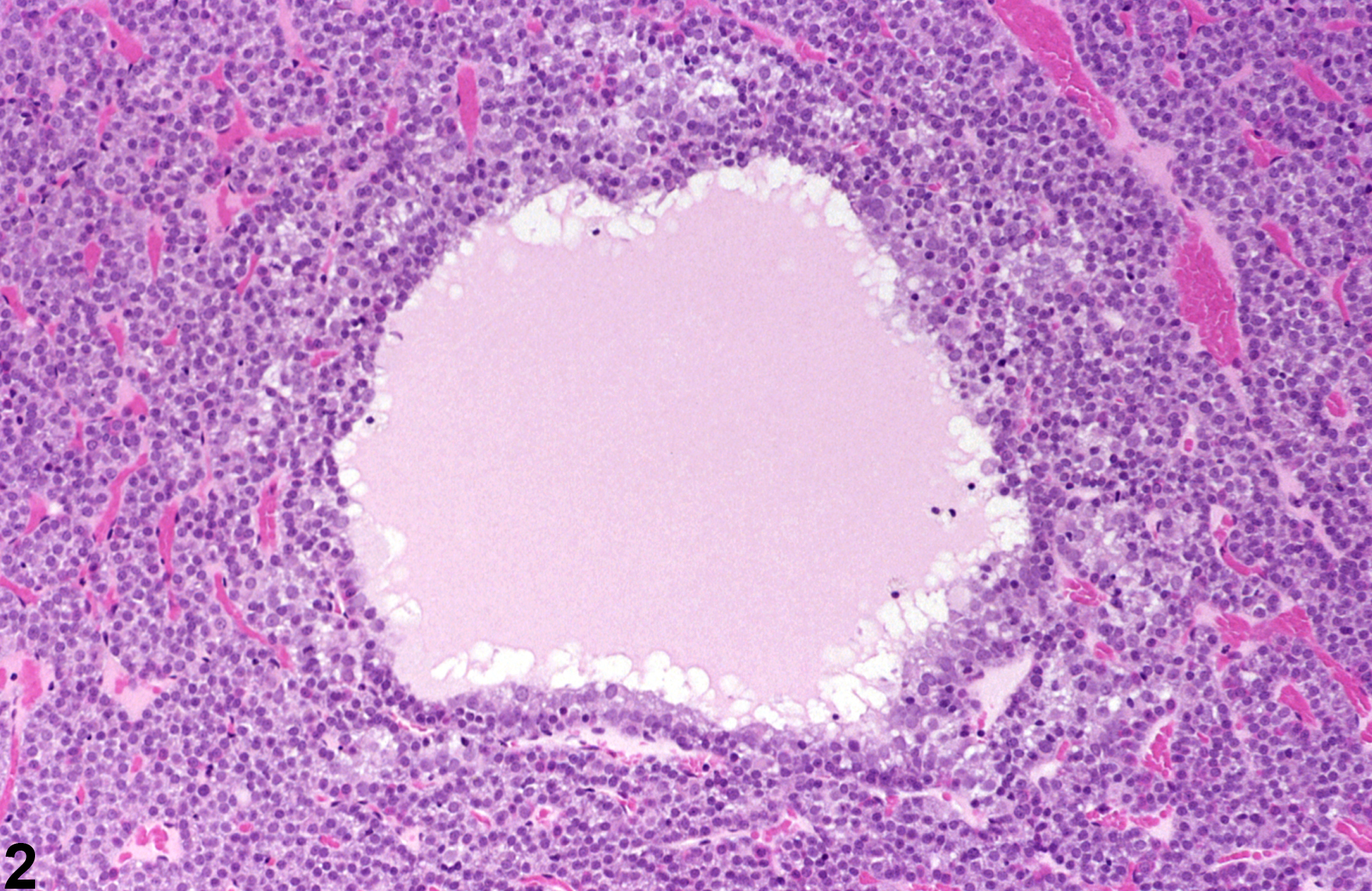 Image of cyst in the pituitary gland from a female Harlan Sprague-Dawley rat in a chronic study