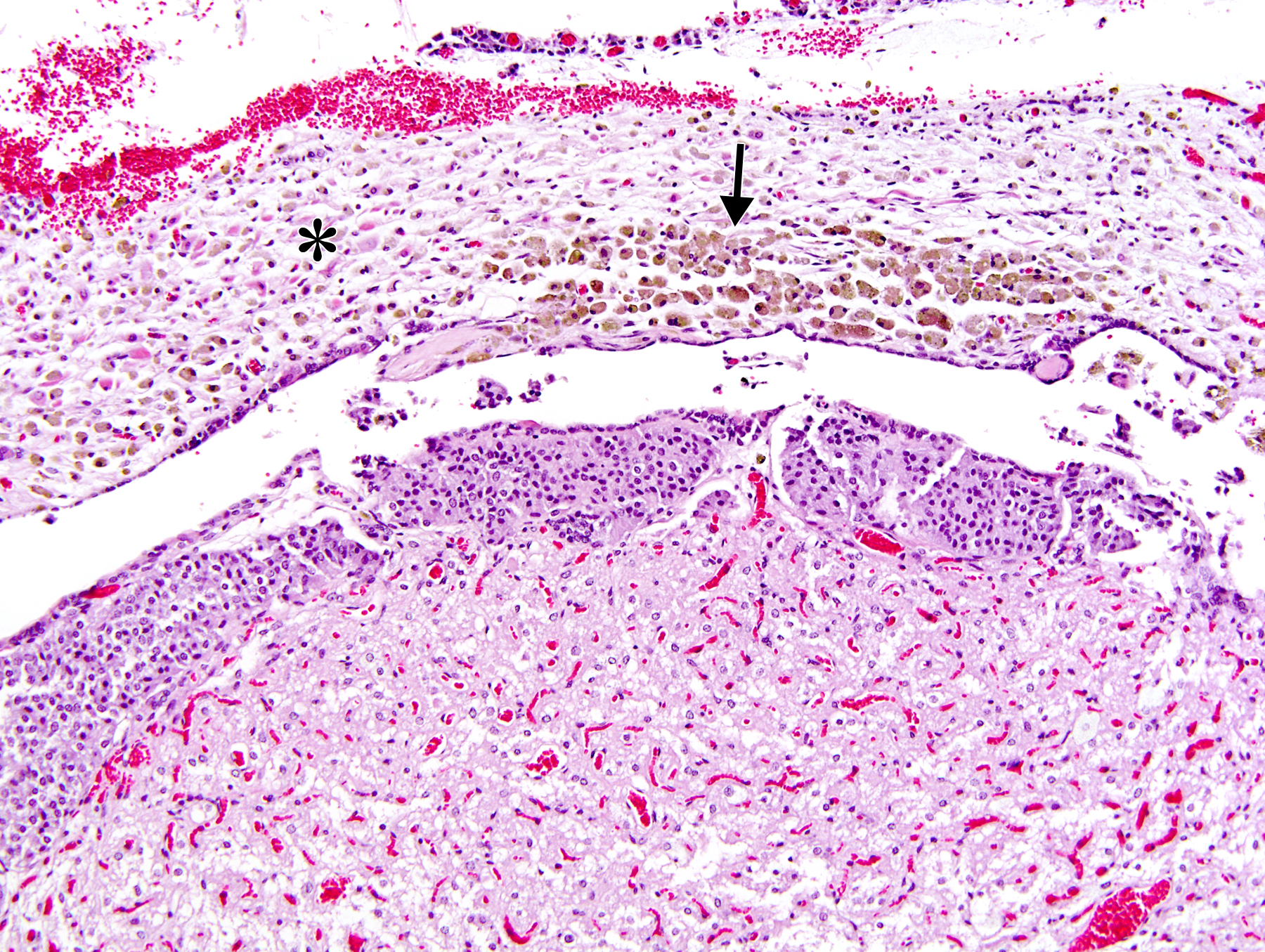 Image of pars distalis atrophy in the pituitary gland from a female F344/N rat in a chronic study