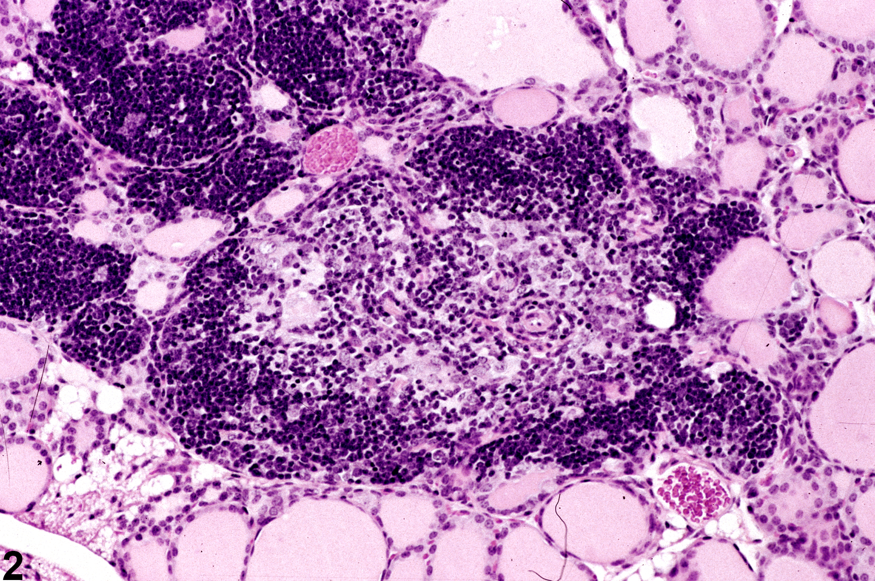 Image of ectopic tissue in the thyroid gland from a female B6C3F1 mouse in a subchronic study