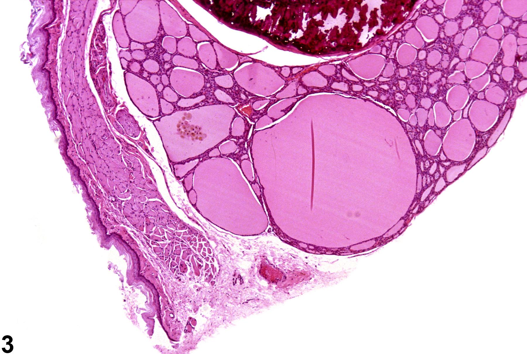 Image of follicle dilation in the thyroid gland from a male F344/N rat in a chronic study